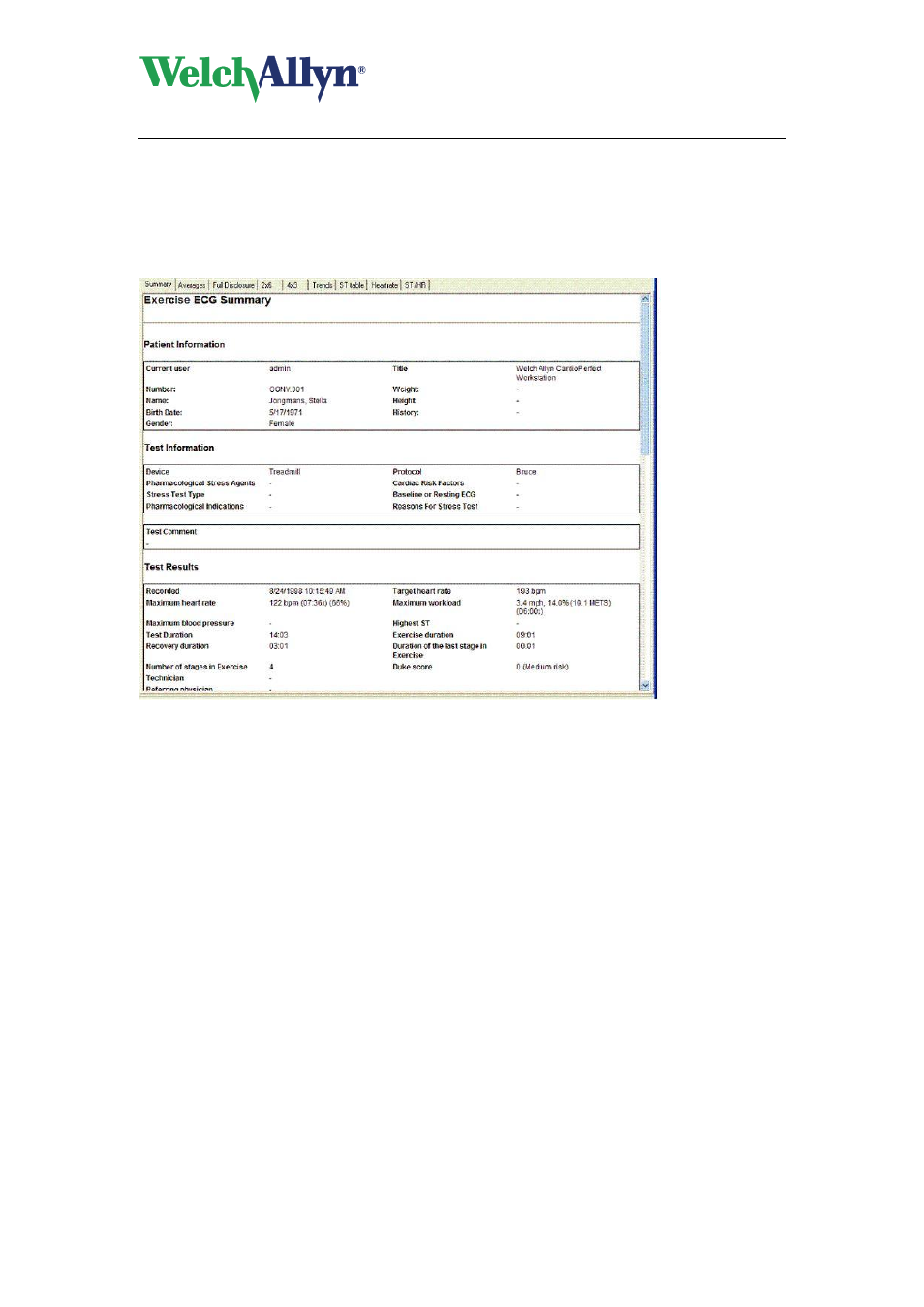 3 work with the summary view, Work with the summary view | Welch Allyn CardioPerfect Workstation Exercise ECG Module - User Manual User Manual | Page 30 / 83
