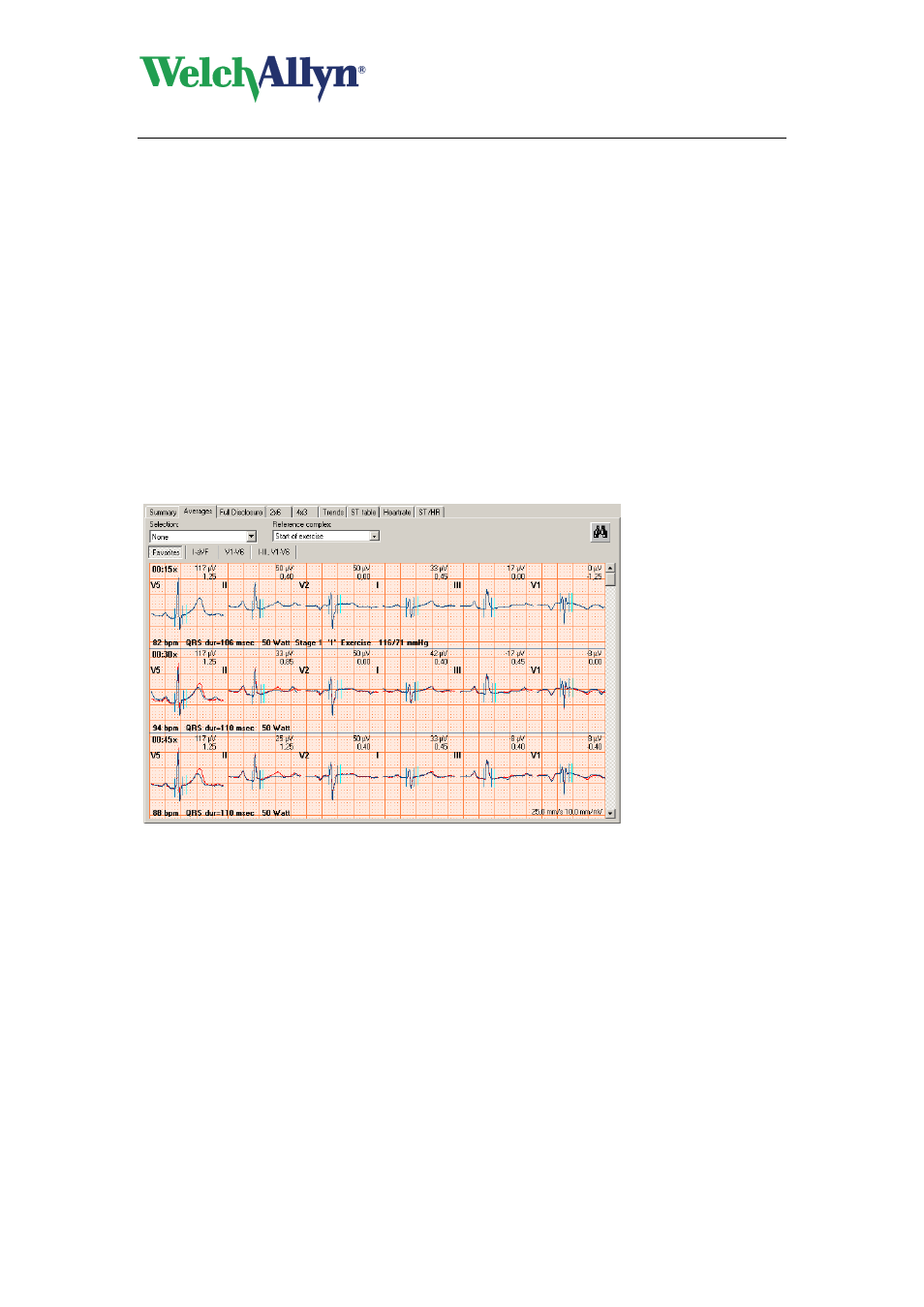 4 work with the averages view, Averages view, Work with the averages view | Welch Allyn CardioPerfect Workstation Exercise ECG Module - User Manual User Manual | Page 31 / 83