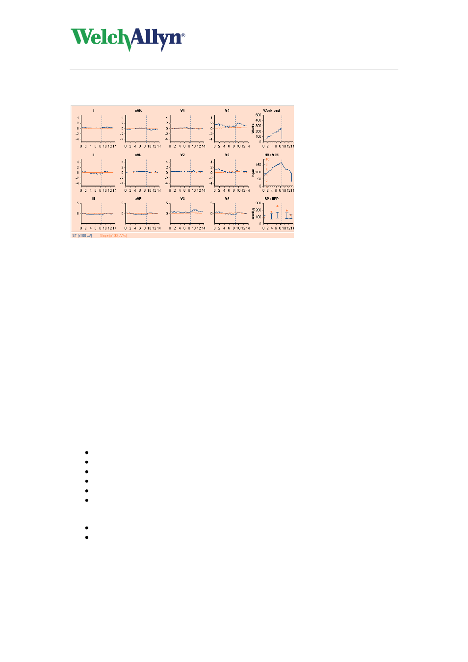 7 work with the trends view, Set a different st reference point, Work with the trends view | Welch Allyn CardioPerfect Workstation Exercise ECG Module - User Manual User Manual | Page 36 / 83