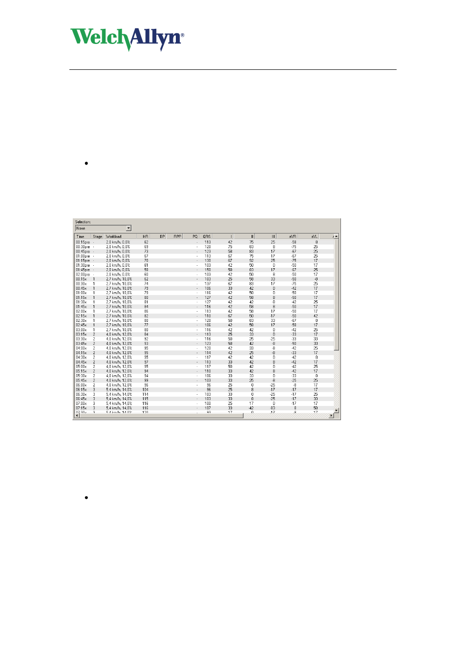 Display st slopes, 8 work with the st table view, Rate pressure product | Work with the st table view | Welch Allyn CardioPerfect Workstation Exercise ECG Module - User Manual User Manual | Page 37 / 83