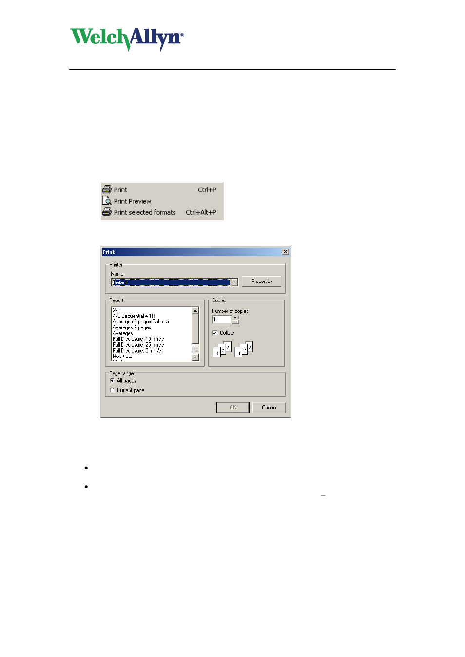 Printing an exercise ecg, 1 print an exercise ecg, Print an exercise ecg | Welch Allyn CardioPerfect Workstation Exercise ECG Module - User Manual User Manual | Page 43 / 83