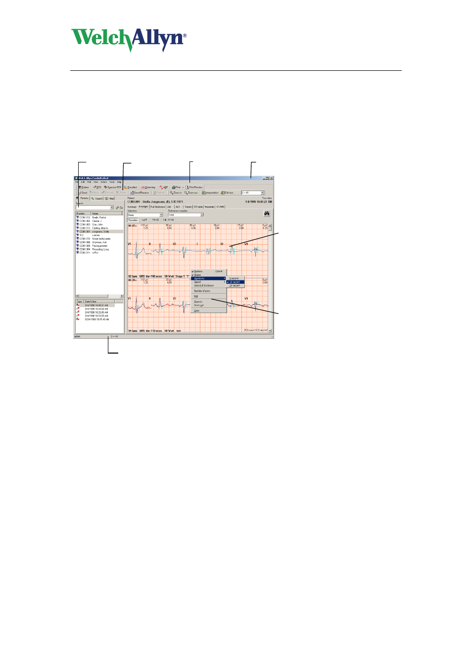 Getting started, The welch allyn cardioperfect exercise ecg window | Welch Allyn CardioPerfect Workstation Exercise ECG Module - User Manual User Manual | Page 8 / 83