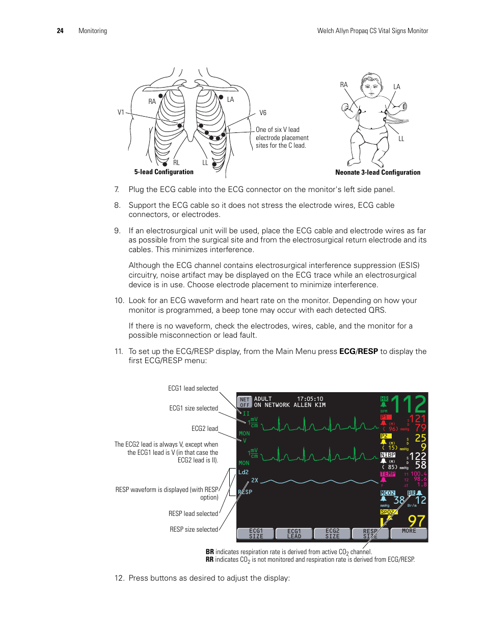 Welch Allyn 246 Propaq CS Vital Signs Monitor v.3.7X - User Manual User Manual | Page 28 / 130