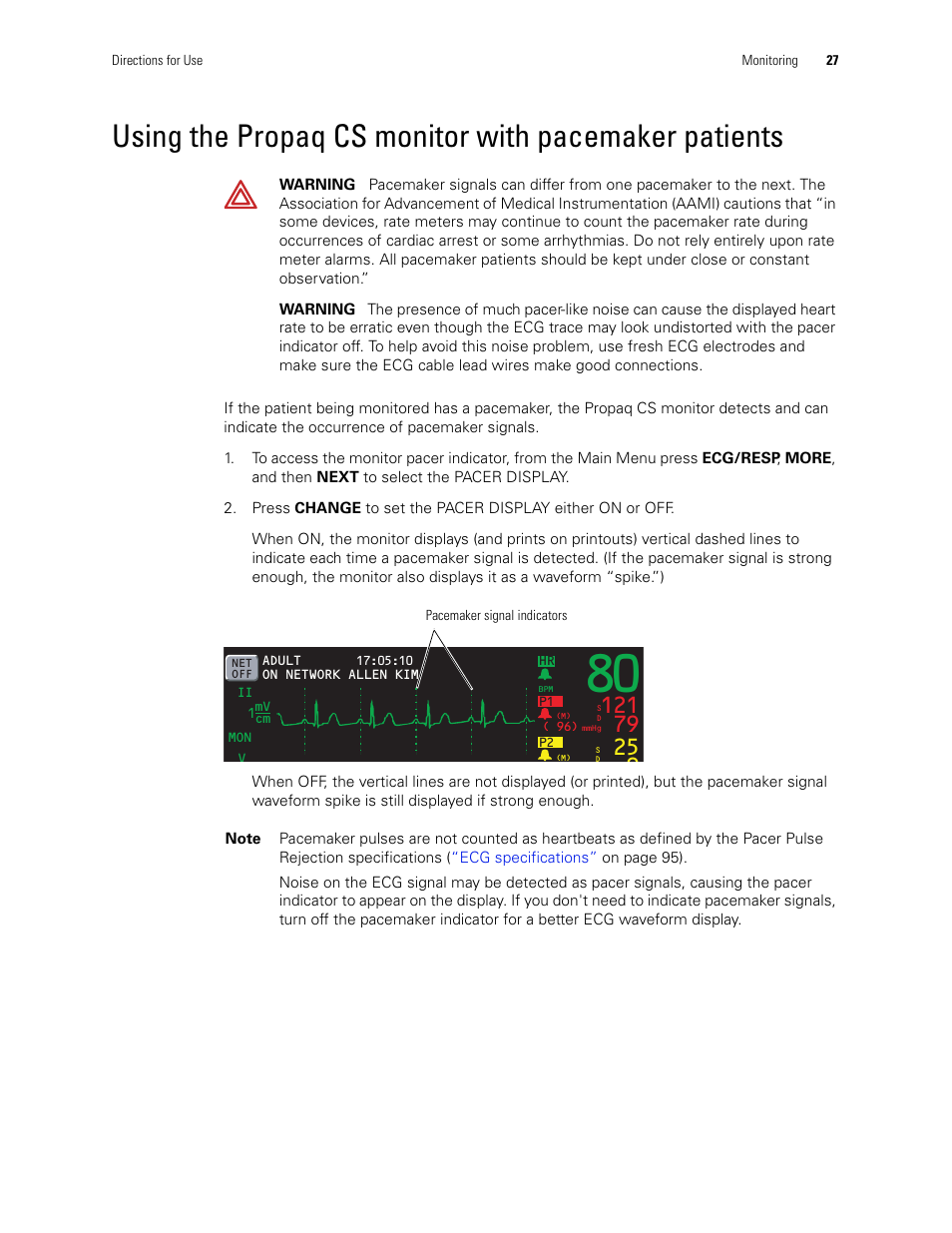 Welch Allyn 246 Propaq CS Vital Signs Monitor v.3.7X - User Manual User Manual | Page 31 / 130