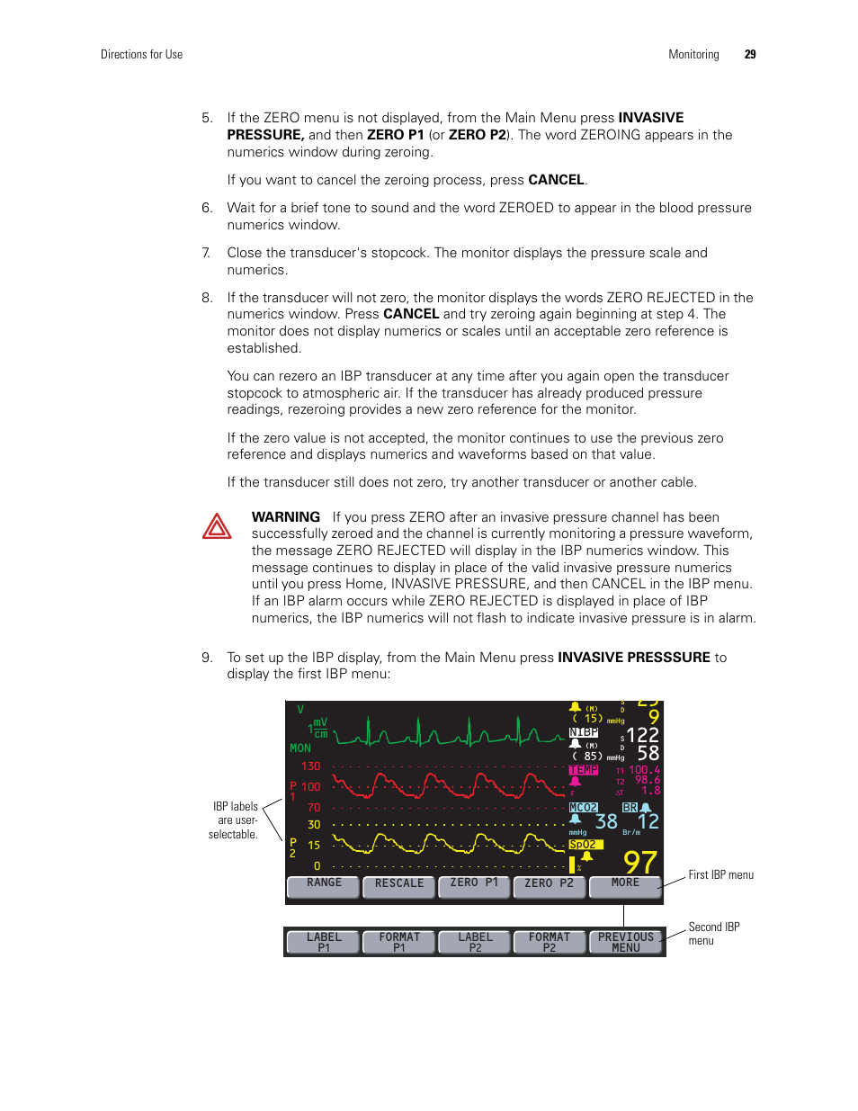 Welch Allyn 246 Propaq CS Vital Signs Monitor v.3.7X - User Manual User Manual | Page 33 / 130