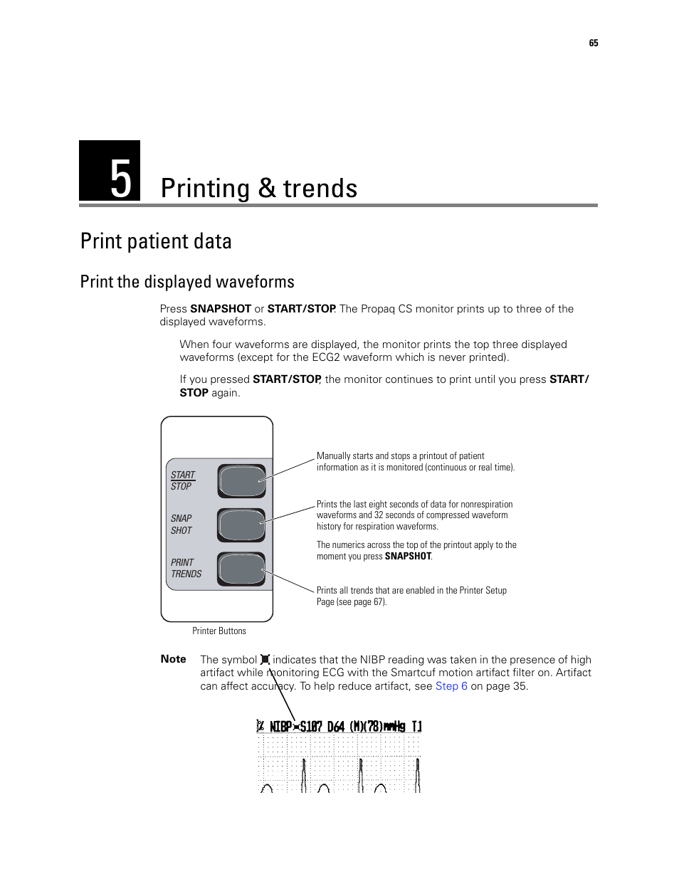 Printing & trends, Print patient data, 5 - printing & trends | Print the displayed waveforms | Welch Allyn 246 Propaq CS Vital Signs Monitor v.3.7X - User Manual User Manual | Page 69 / 130