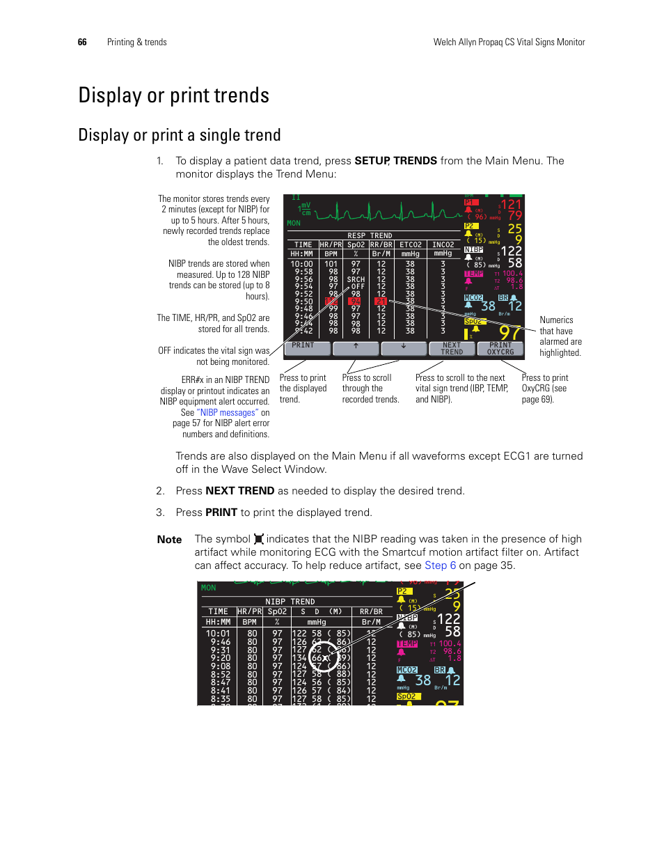 Display or print trends, Display or print a single trend | Welch Allyn 246 Propaq CS Vital Signs Monitor v.3.7X - User Manual User Manual | Page 70 / 130