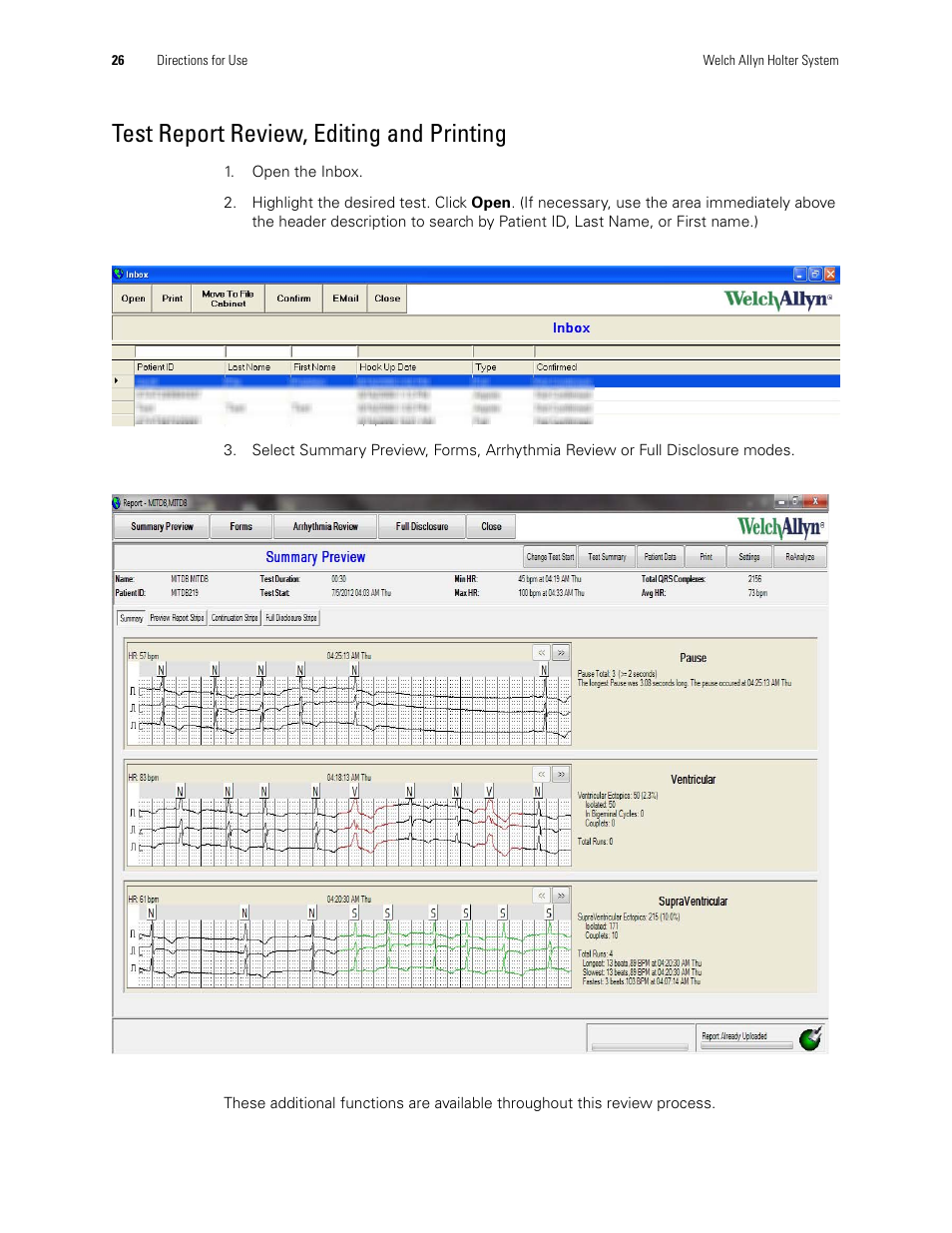 Test report review, editing and printing | Welch Allyn Holter System - User Manual User Manual | Page 30 / 70