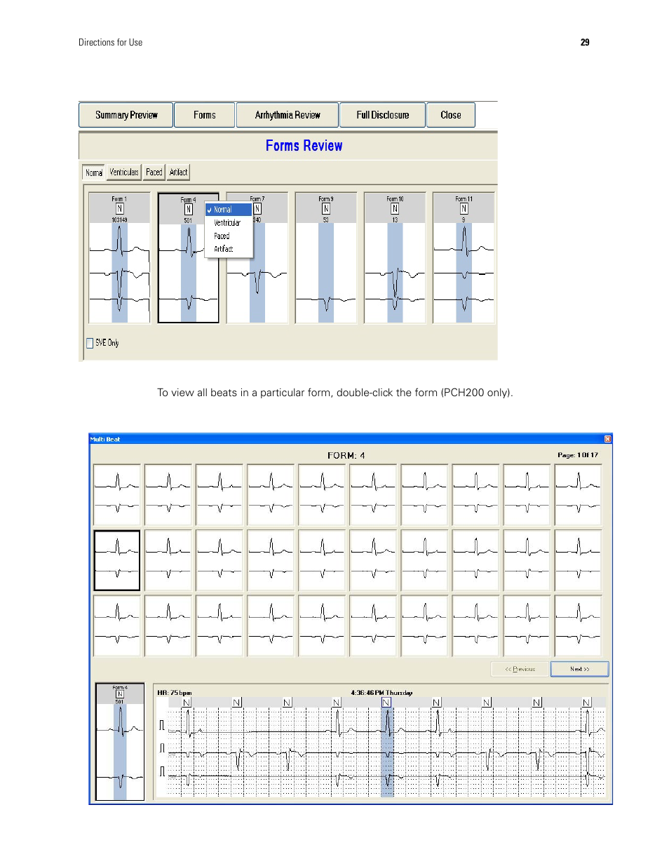 Welch Allyn Holter System - User Manual User Manual | Page 33 / 70