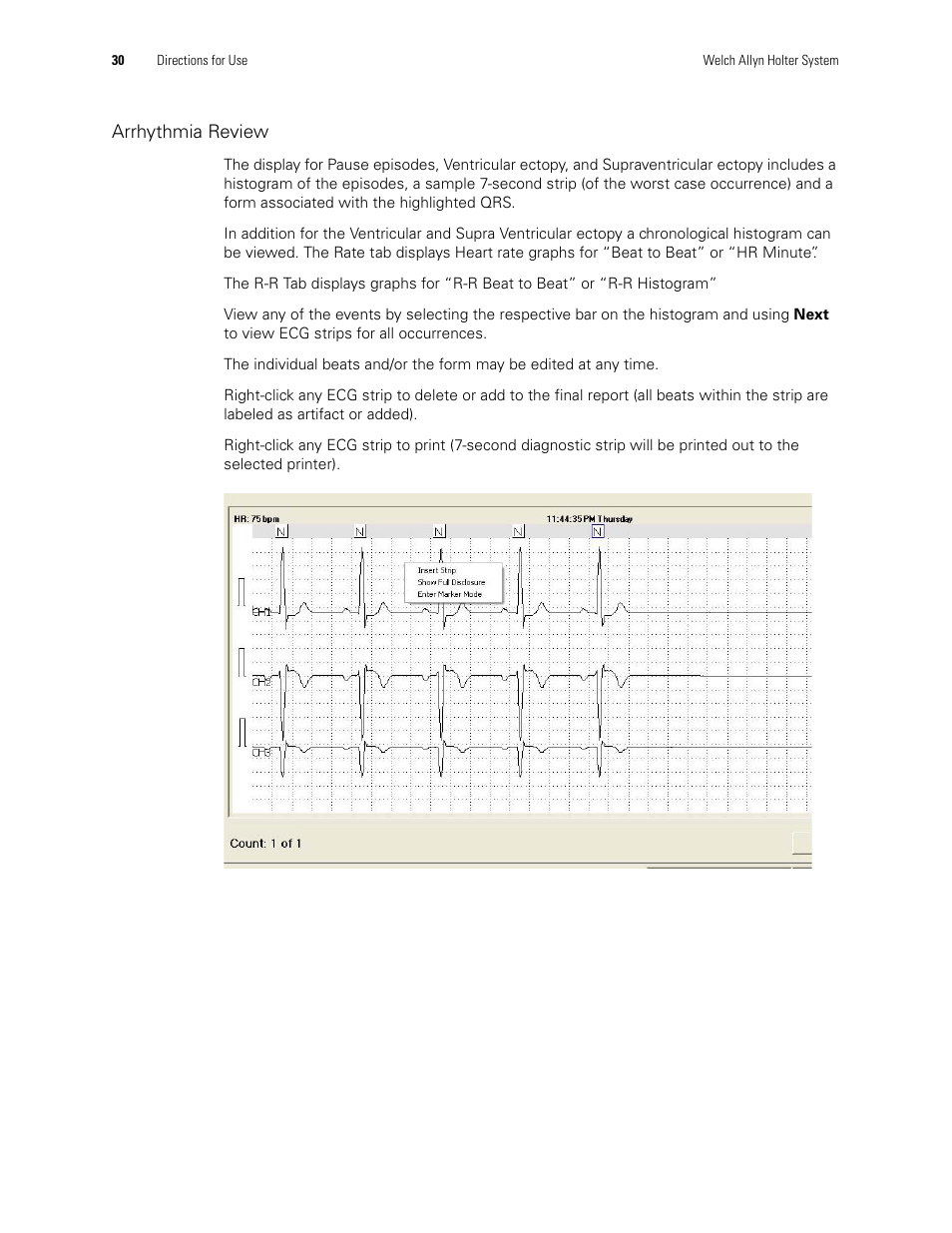 Arrhythmia review | Welch Allyn Holter System - User Manual User Manual | Page 34 / 70