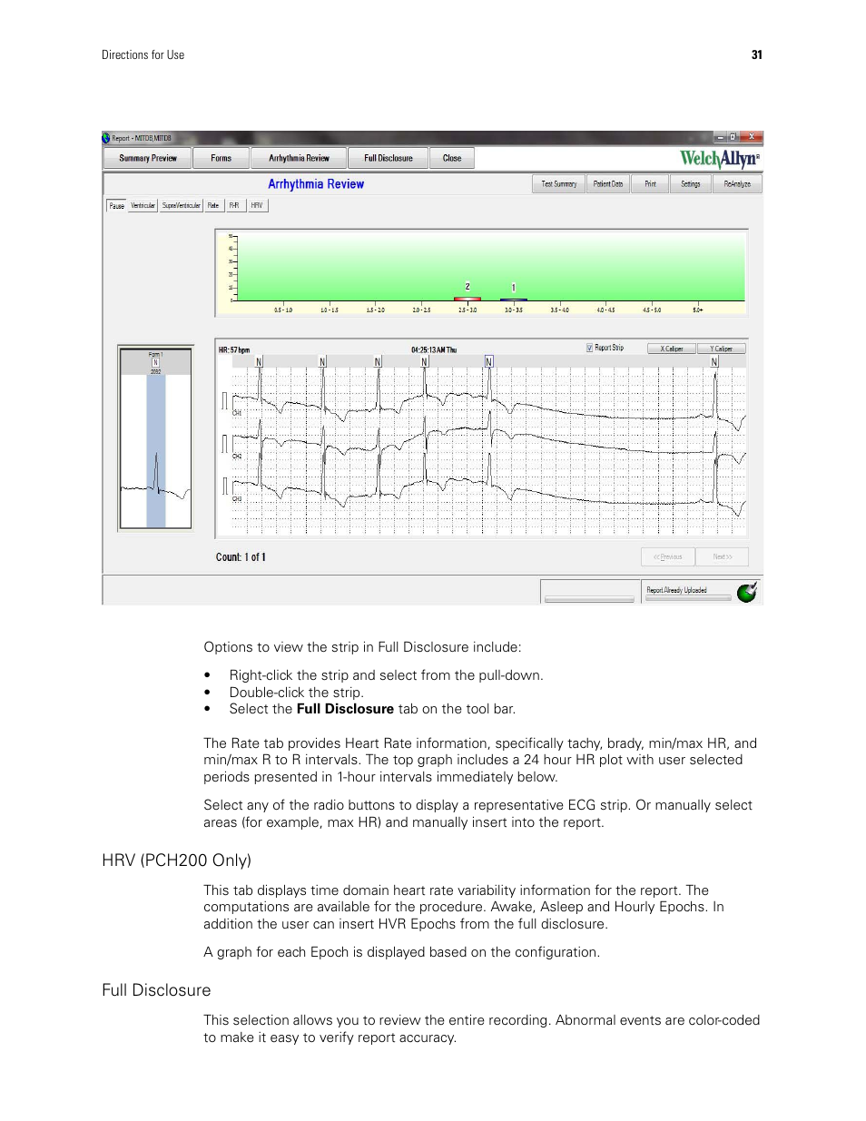 Hrv (pch200 only), Full disclosure | Welch Allyn Holter System - User Manual User Manual | Page 35 / 70