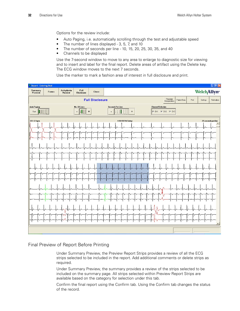 Final preview of report before printing | Welch Allyn Holter System - User Manual User Manual | Page 36 / 70