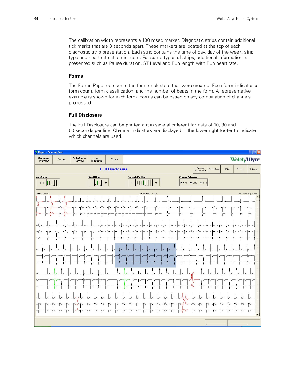 Welch Allyn Holter System - User Manual User Manual | Page 50 / 70