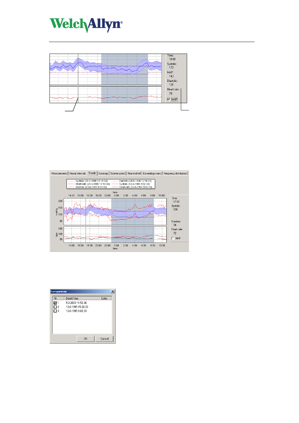 Compare abp tests of the same patient, To make a comparison, Right click on the graph | In the shortcut menu, click comparison, Cardioperfect workstation, Abp module - user manual | Welch Allyn CardioPerfect Workstation ABP Module - User Manual User Manual | Page 21 / 40