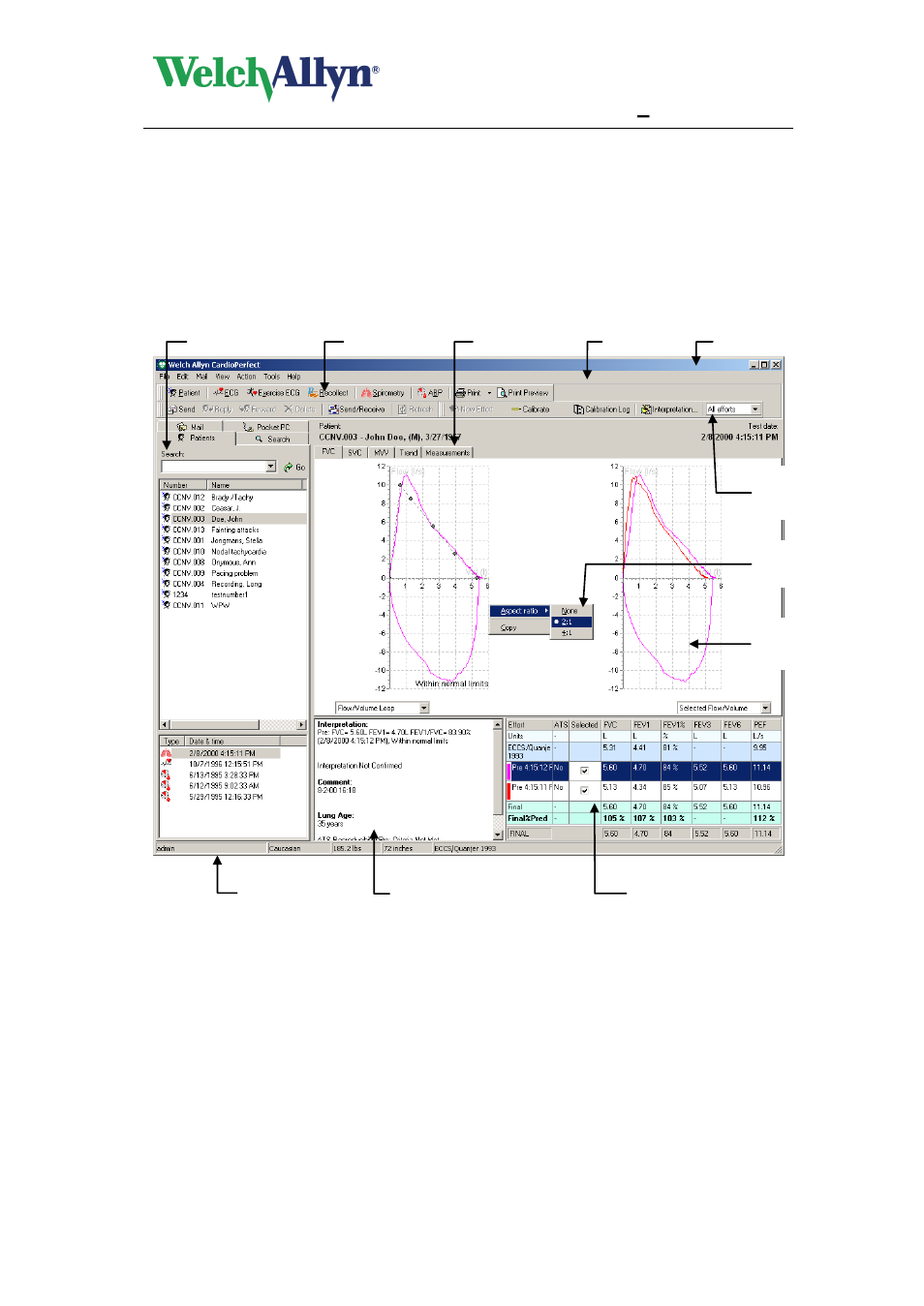 4 the spirometer window, The spirometer window, 4the spirometer window | Cardioperfect workstation, Spiroperfect module – user manual | Welch Allyn CardioPerfect Workstation SpiroPerfect Module - User Manual User Manual | Page 18 / 95