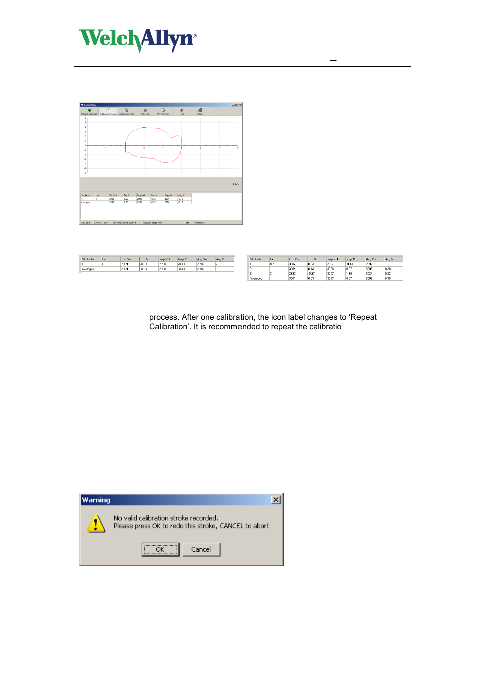 Error messages associated with failed calibration, Cardioperfect workstation, Spiroperfect module – user manual | Welch Allyn CardioPerfect Workstation SpiroPerfect Module - User Manual User Manual | Page 38 / 95