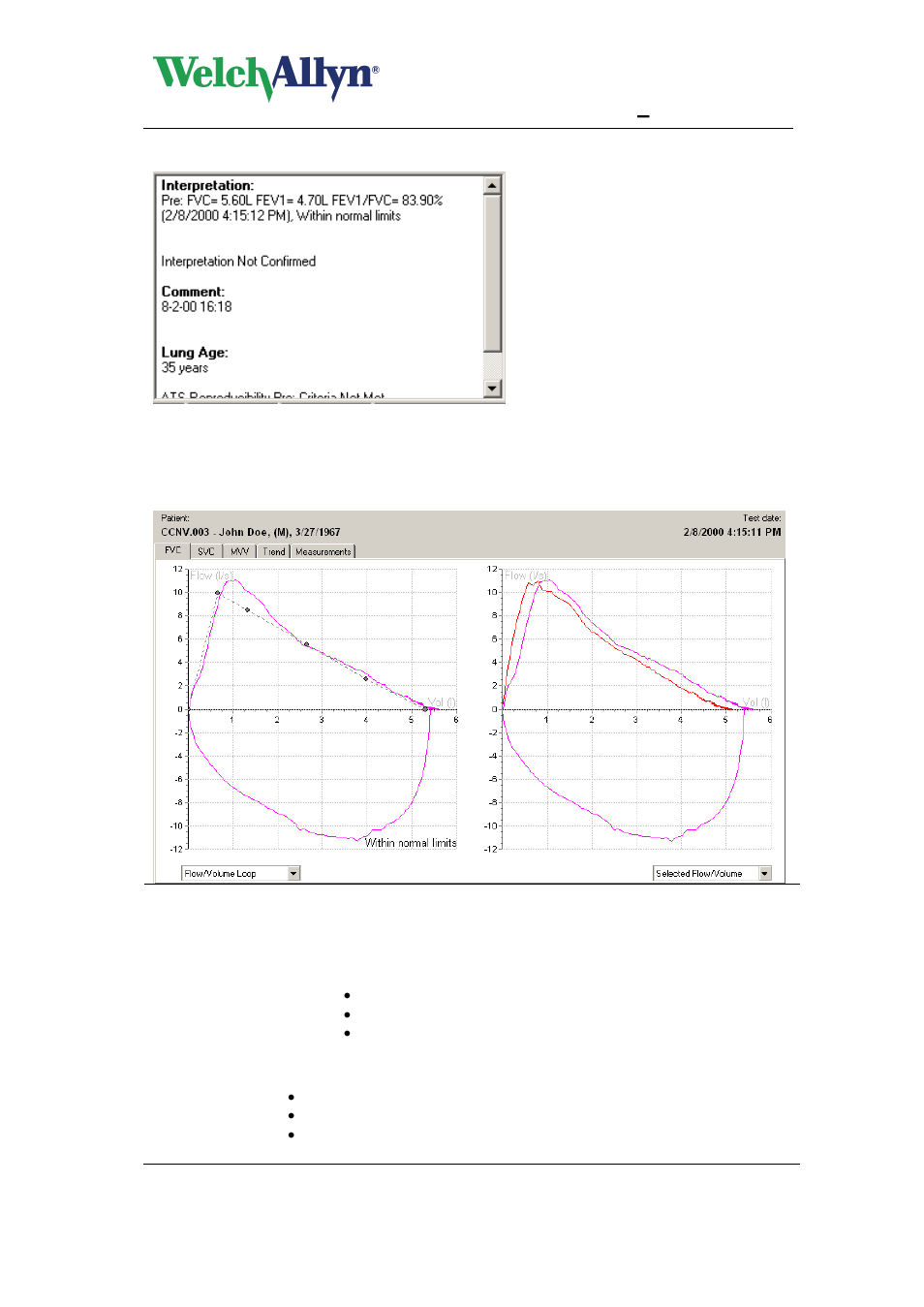6 fvc tab, Fvc tab, Cardioperfect workstation | Spiroperfect module – user manual | Welch Allyn CardioPerfect Workstation SpiroPerfect Module - User Manual User Manual | Page 53 / 95