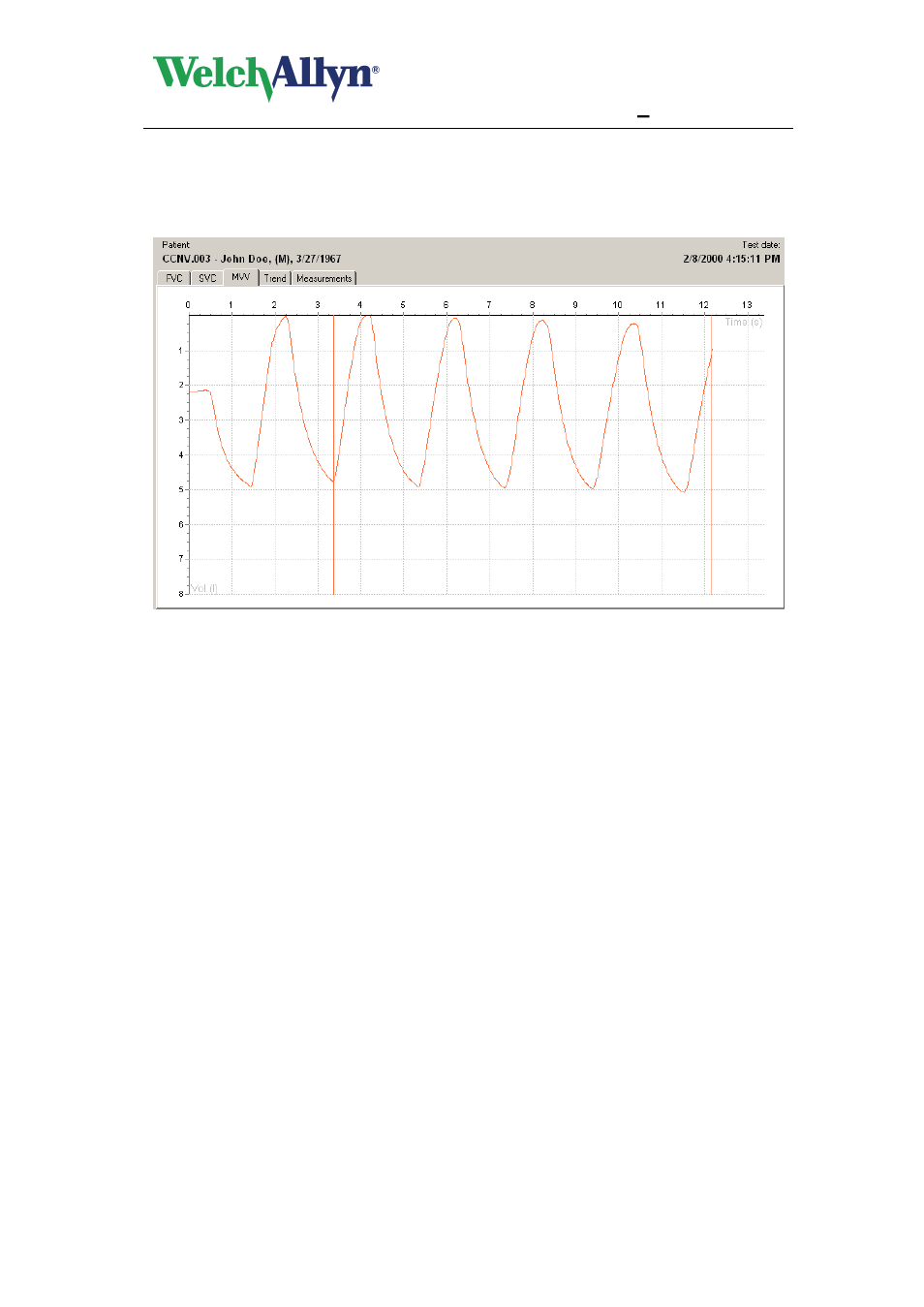 8 mvv tab, Mvv tab, Cardioperfect workstation | Spiroperfect module – user manual | Welch Allyn CardioPerfect Workstation SpiroPerfect Module - User Manual User Manual | Page 55 / 95