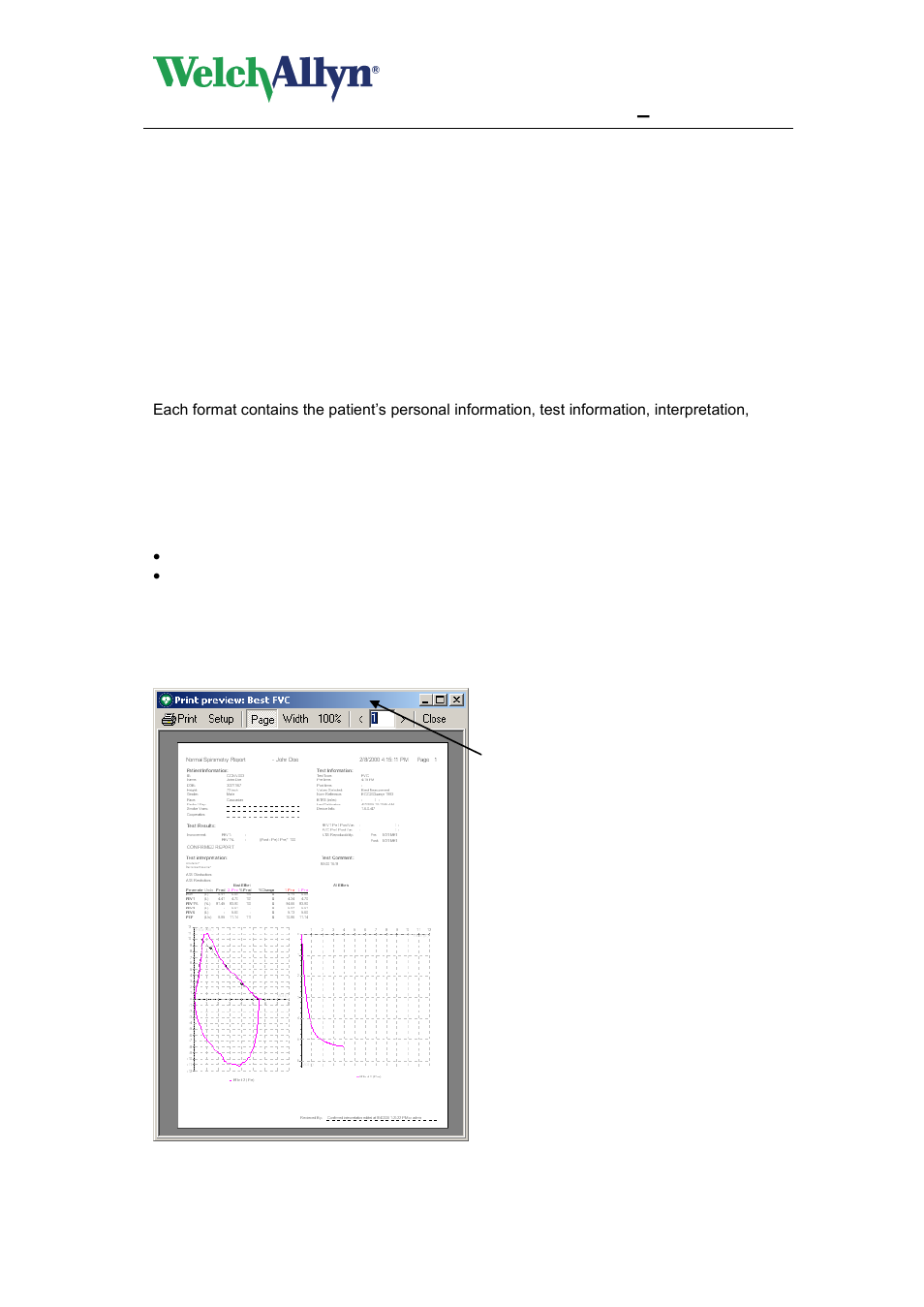 2 print report formats, 3 print preview, Print report formats | Print preview, Cardioperfect workstation, Spiroperfect module – user manual | Welch Allyn CardioPerfect Workstation SpiroPerfect Module - User Manual User Manual | Page 63 / 95