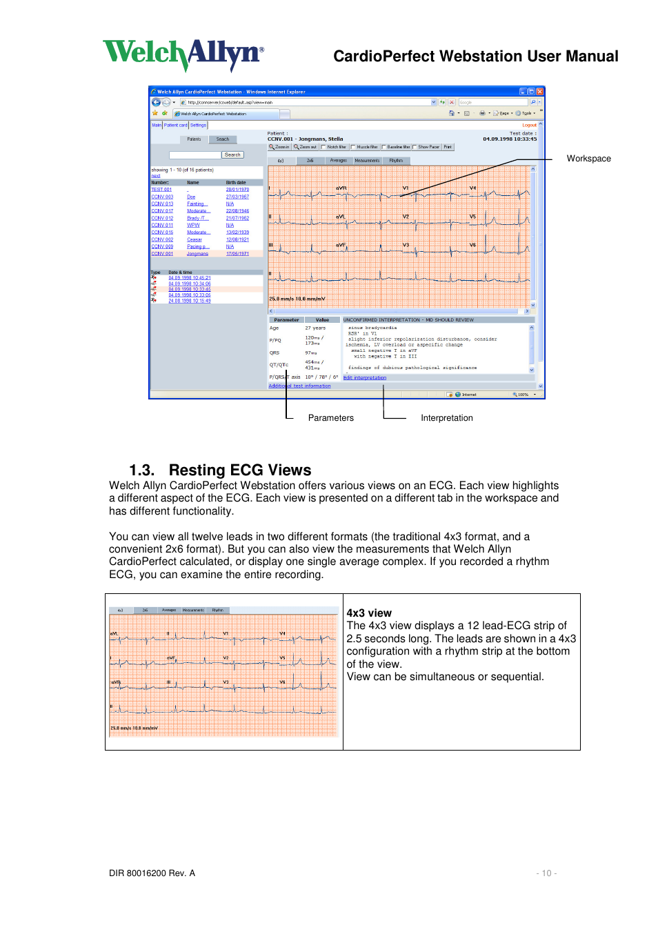 Cardioperfect webstation user manual, Resting ecg views | Welch Allyn CardioPerfect Webstation 2.0 - User Manual User Manual | Page 10 / 24