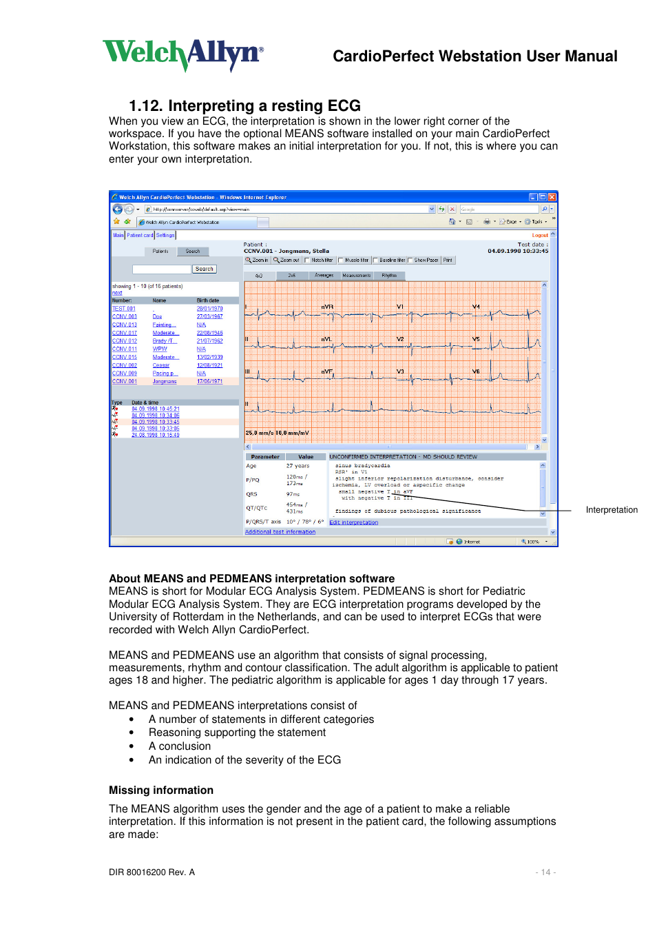 Cardioperfect webstation user manual, Interpreting a resting ecg | Welch Allyn CardioPerfect Webstation 2.0 - User Manual User Manual | Page 14 / 24