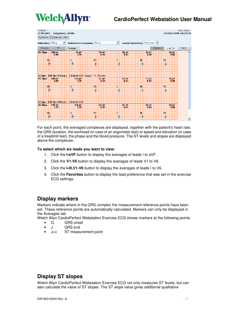 Cardioperfect webstation user manual, Display markers, Display st slopes | Welch Allyn CardioPerfect Webstation 2.0 - User Manual User Manual | Page 21 / 24