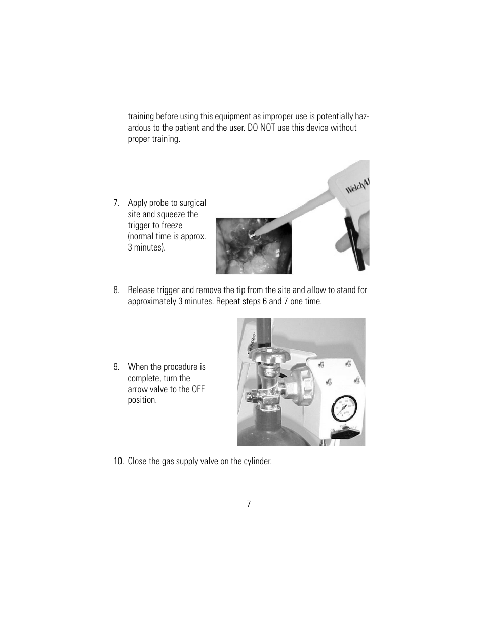 Welch Allyn 88372 Cryosurgery System - User Manual User Manual | Page 9 / 14