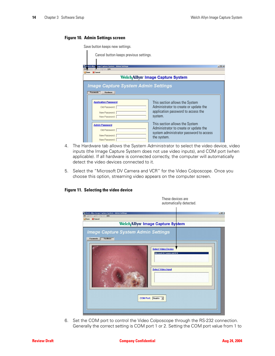 Welch Allyn Image Capture System - User Manual User Manual | Page 22 / 50