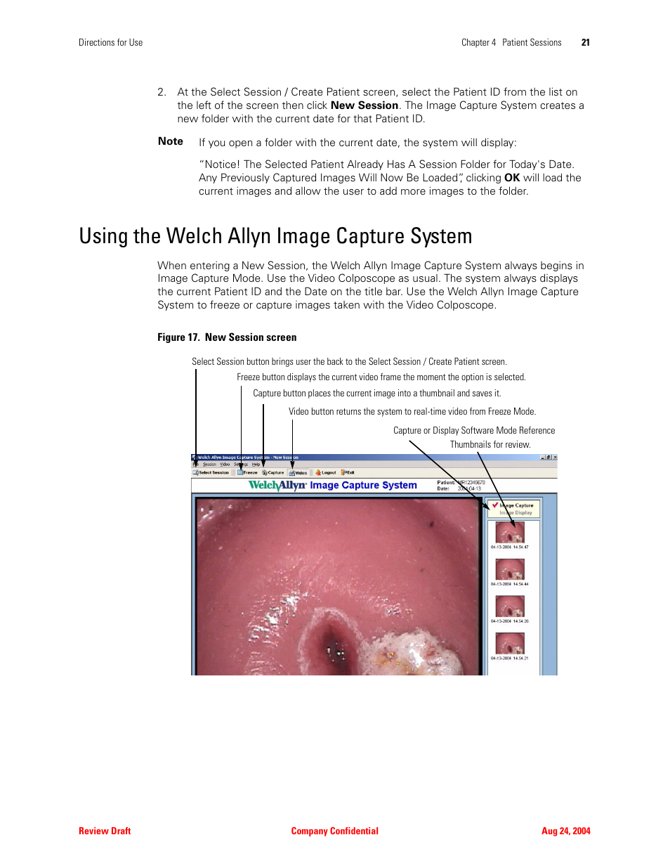 Using the welch allyn image capture system | Welch Allyn Image Capture System - User Manual User Manual | Page 29 / 50