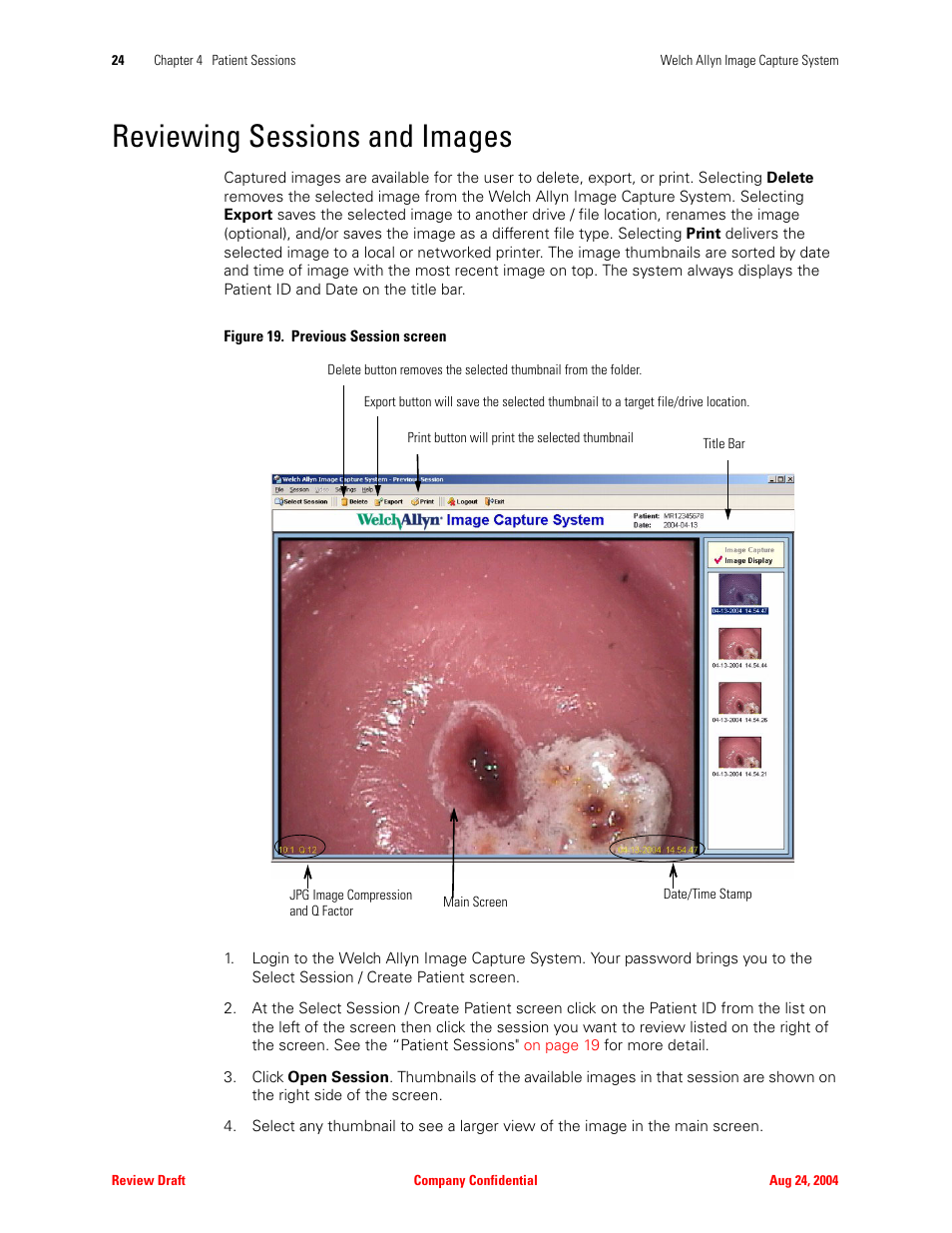 Reviewing sessions and images, He “reviewing sessions and images | Welch Allyn Image Capture System - User Manual User Manual | Page 32 / 50