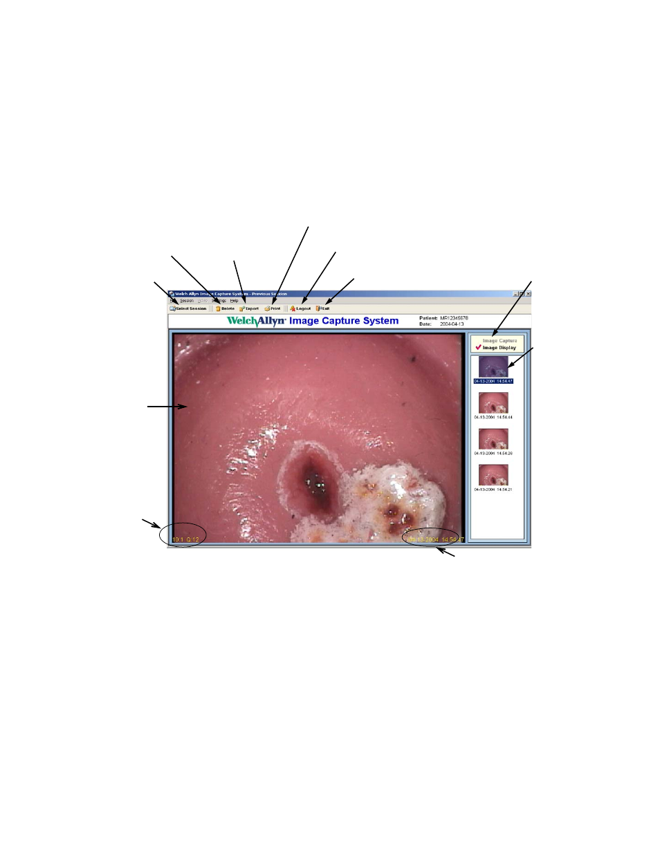 Reviewing sessions and images, Deleting an image | Welch Allyn Image Capture System - User Manual User Manual | Page 23 / 38