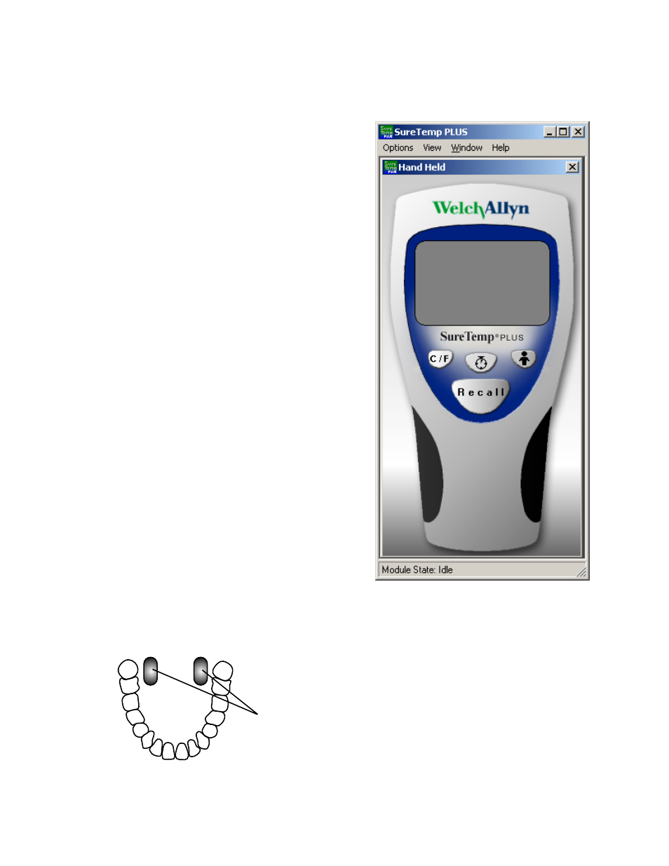 Suretemp plus pc display, Operation | Welch Allyn SureTemp PlusModule - User Manual User Manual | Page 78 / 85