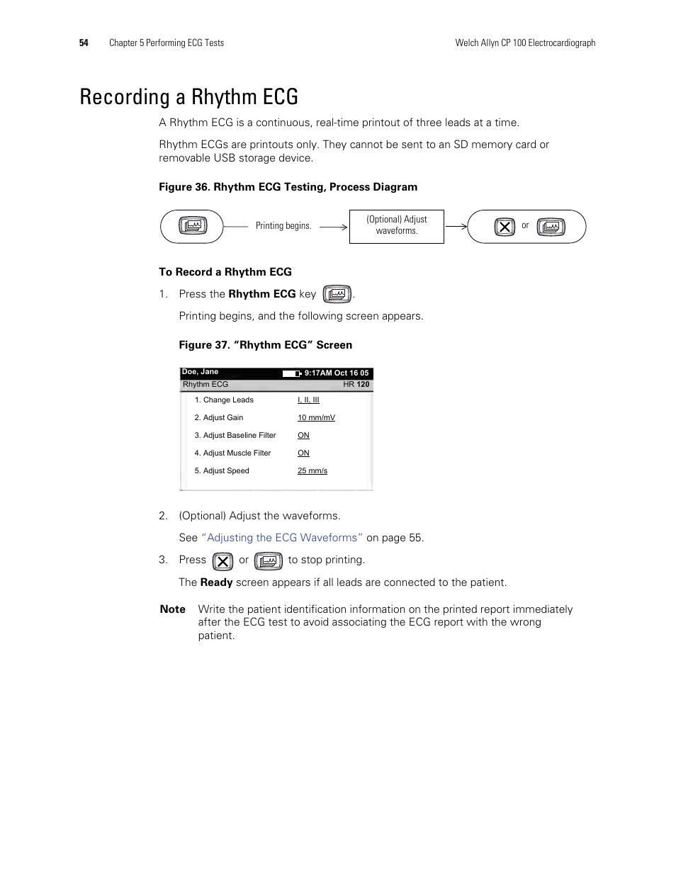 Recording a rhythm ecg | Welch Allyn CP Series Electrocardiographs - User Manual User Manual | Page 28 / 40