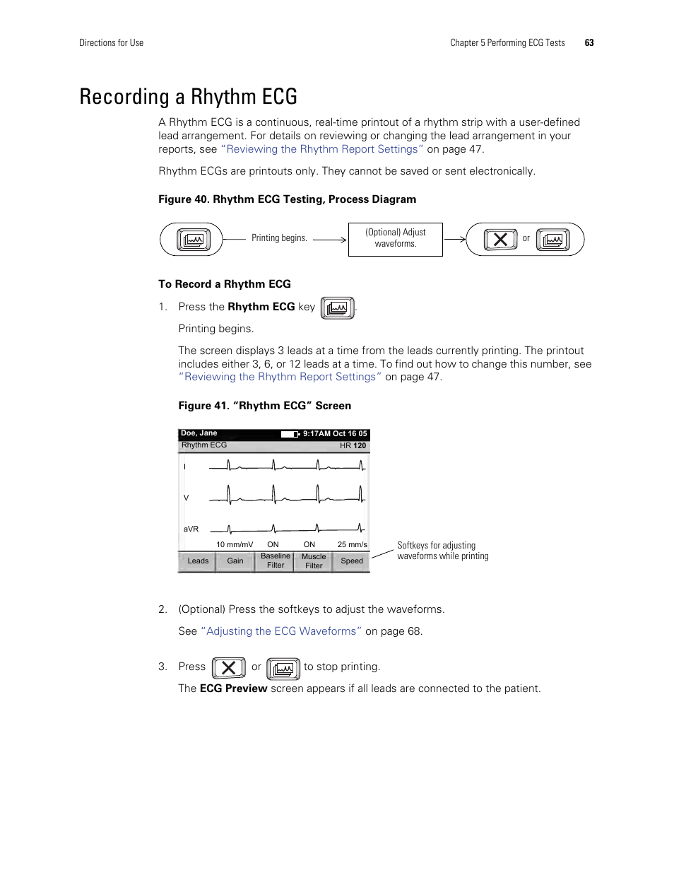 Recording a rhythm ecg | Welch Allyn CP Series Electrocardiographs - User Manual User Manual | Page 37 / 40