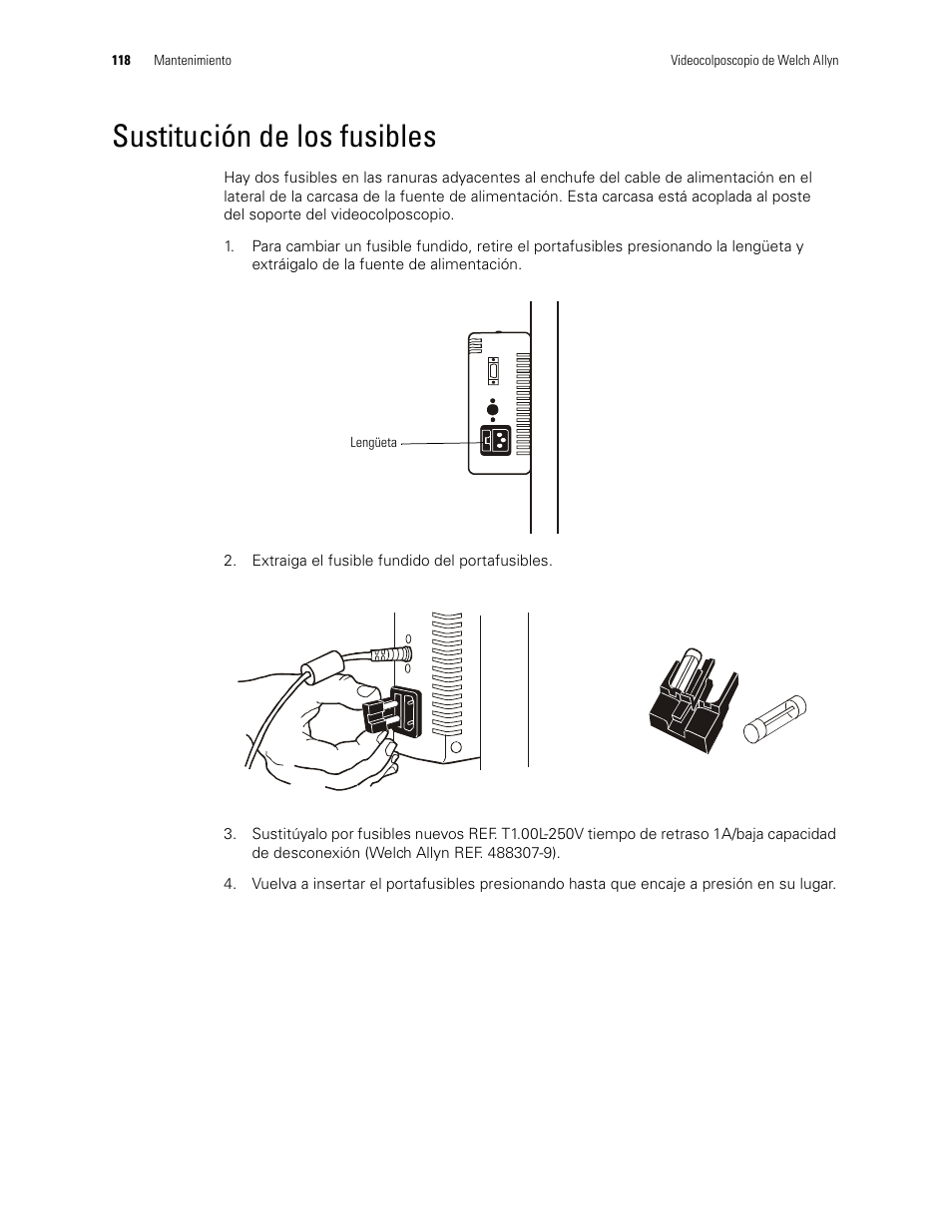 Sustitución de los fusibles | Welch Allyn Video Colposcope - User Manual User Manual | Page 120 / 400