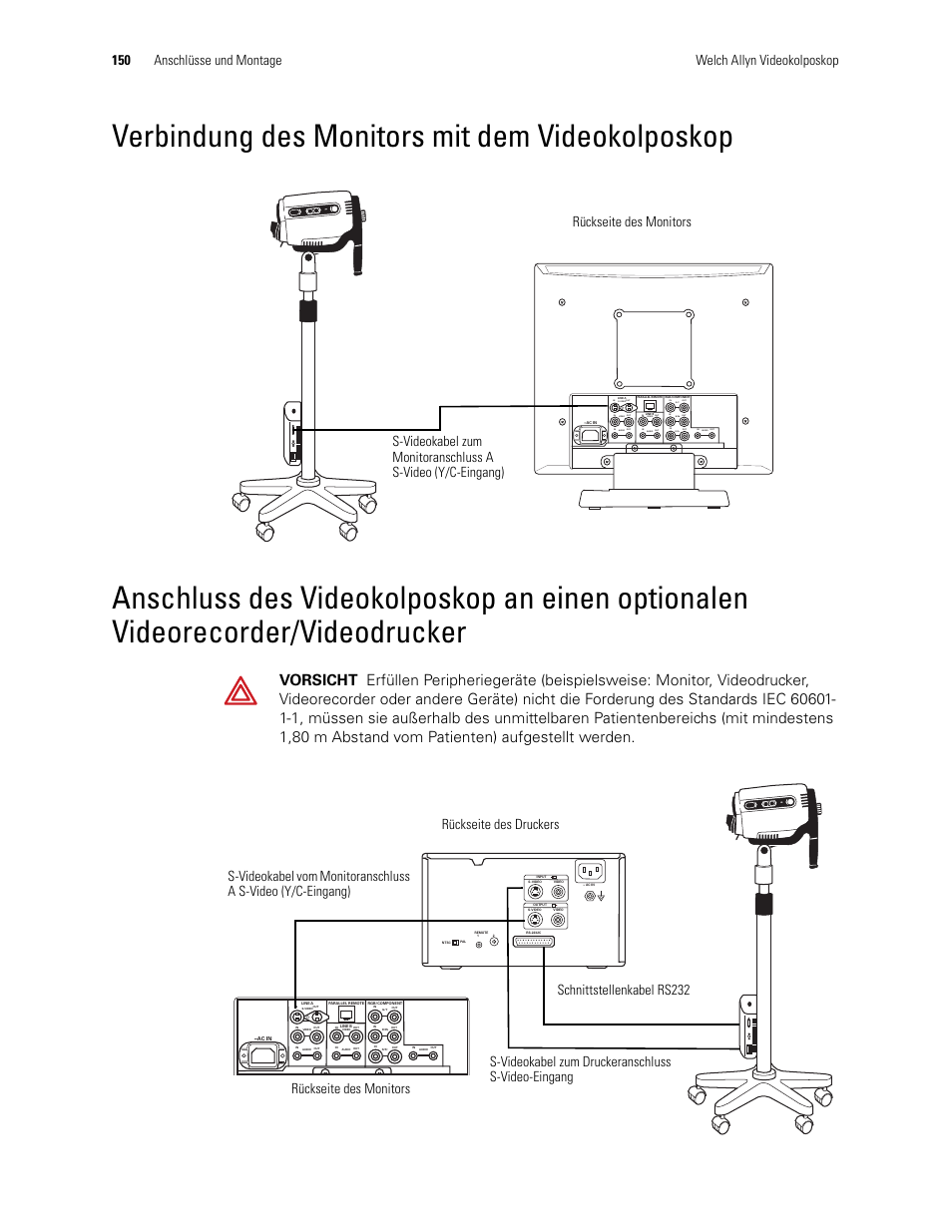Videodrucker, Verbindung des monitors mit dem videokolposkop | Welch Allyn Video Colposcope - User Manual User Manual | Page 152 / 400