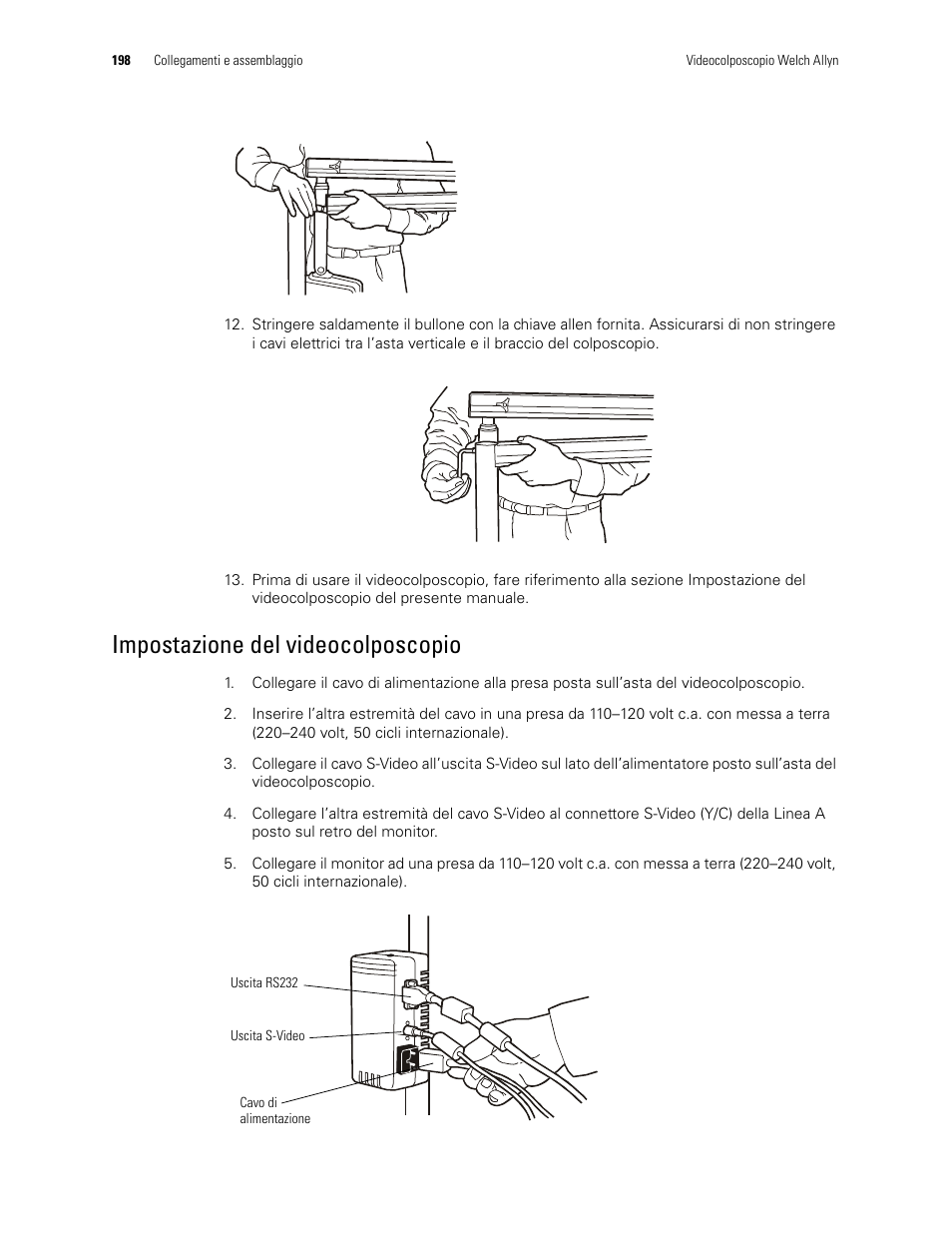 Impostazione del videocolposcopio | Welch Allyn Video Colposcope - User Manual User Manual | Page 200 / 400