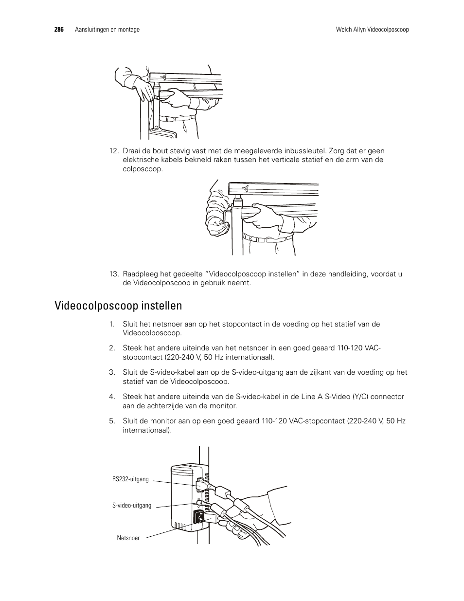 Videocolposcoop instellen | Welch Allyn Video Colposcope - User Manual User Manual | Page 288 / 400