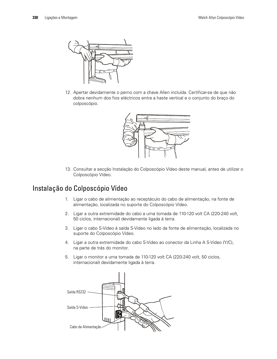 Instalação do colposcópio vídeo | Welch Allyn Video Colposcope - User Manual User Manual | Page 332 / 400