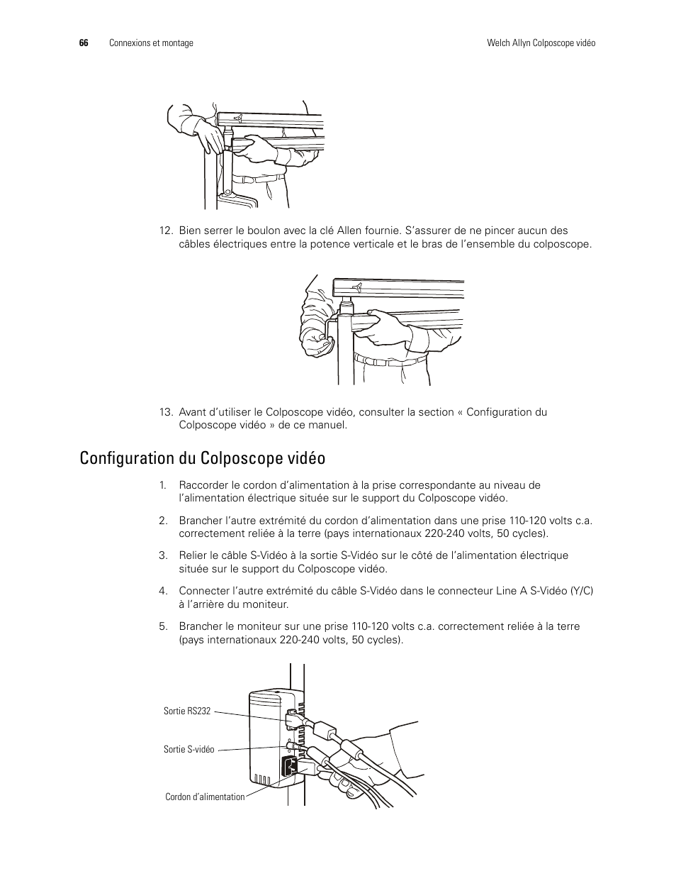 Configuration du colposcope vidéo | Welch Allyn Video Colposcope - User Manual User Manual | Page 68 / 400