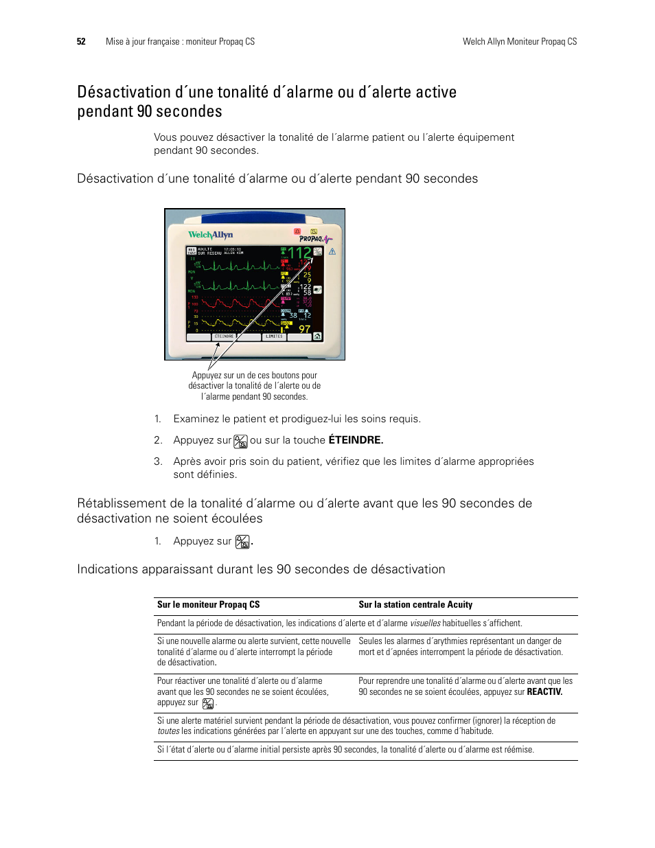 90 secondes | Welch Allyn Propaq CS Monitor - User Manual User Manual | Page 60 / 152