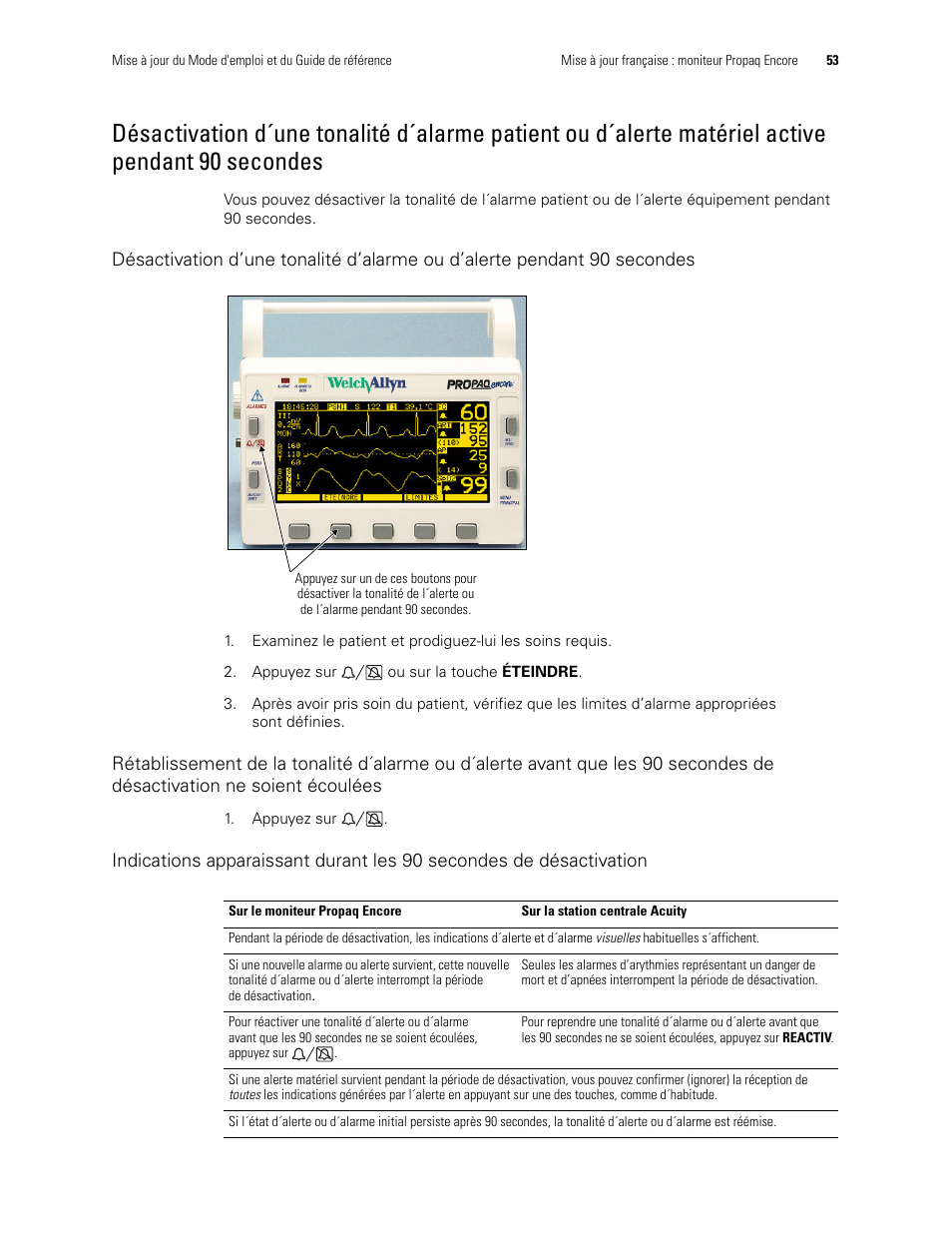 Pendant 90 secondes | Welch Allyn Propaq Encore Monitor - User Manual User Manual | Page 61 / 136