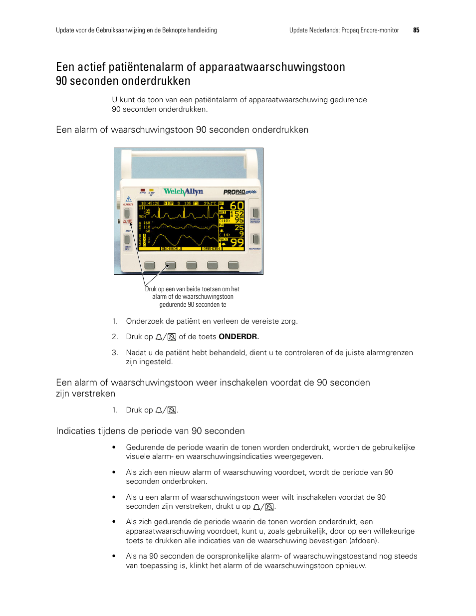 Indicaties tijdens de periode van 90 seconden, 90 seconden onderdrukken | Welch Allyn Propaq Encore Monitor - User Manual User Manual | Page 93 / 136