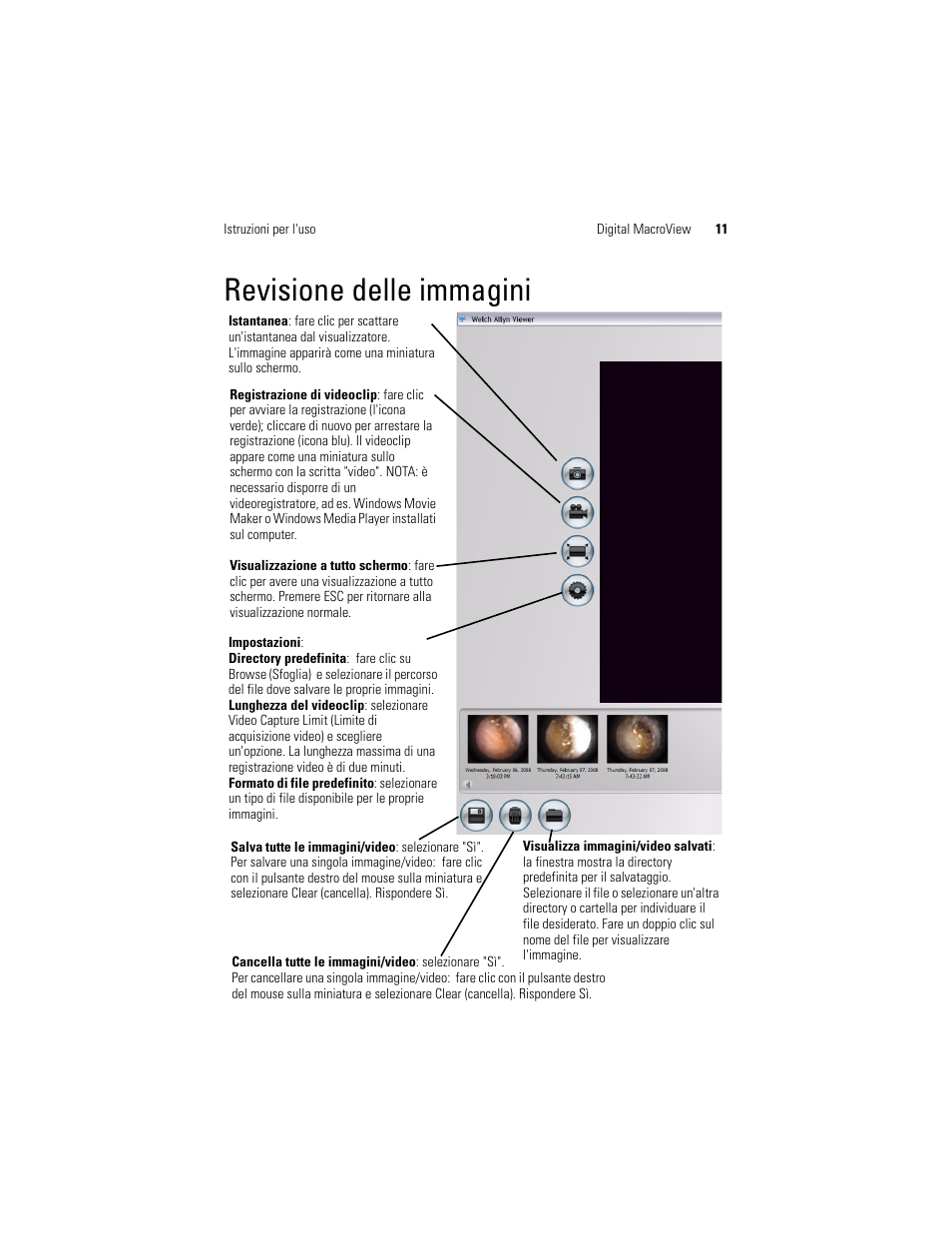 Revisione delle immagini | Welch Allyn Digital MacroView Otoscope - User Manual User Manual | Page 115 / 476