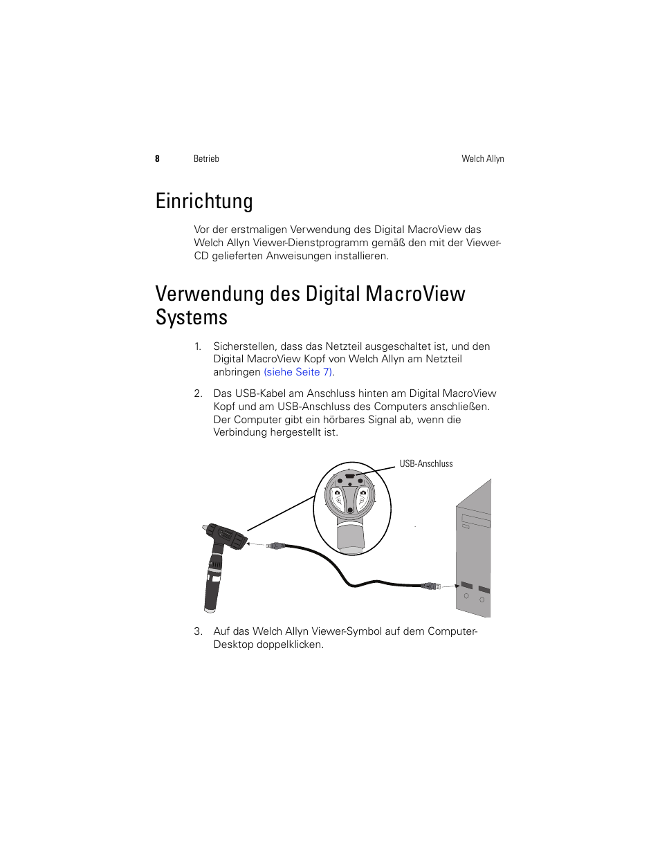 Einrichtung, Verwendung des digital macroview systems | Welch Allyn Digital MacroView Otoscope - User Manual User Manual | Page 144 / 476