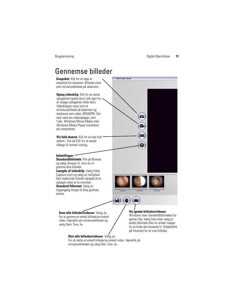 Gennemse billeder | Welch Allyn Digital MacroView Otoscope - User Manual User Manual | Page 179 / 476