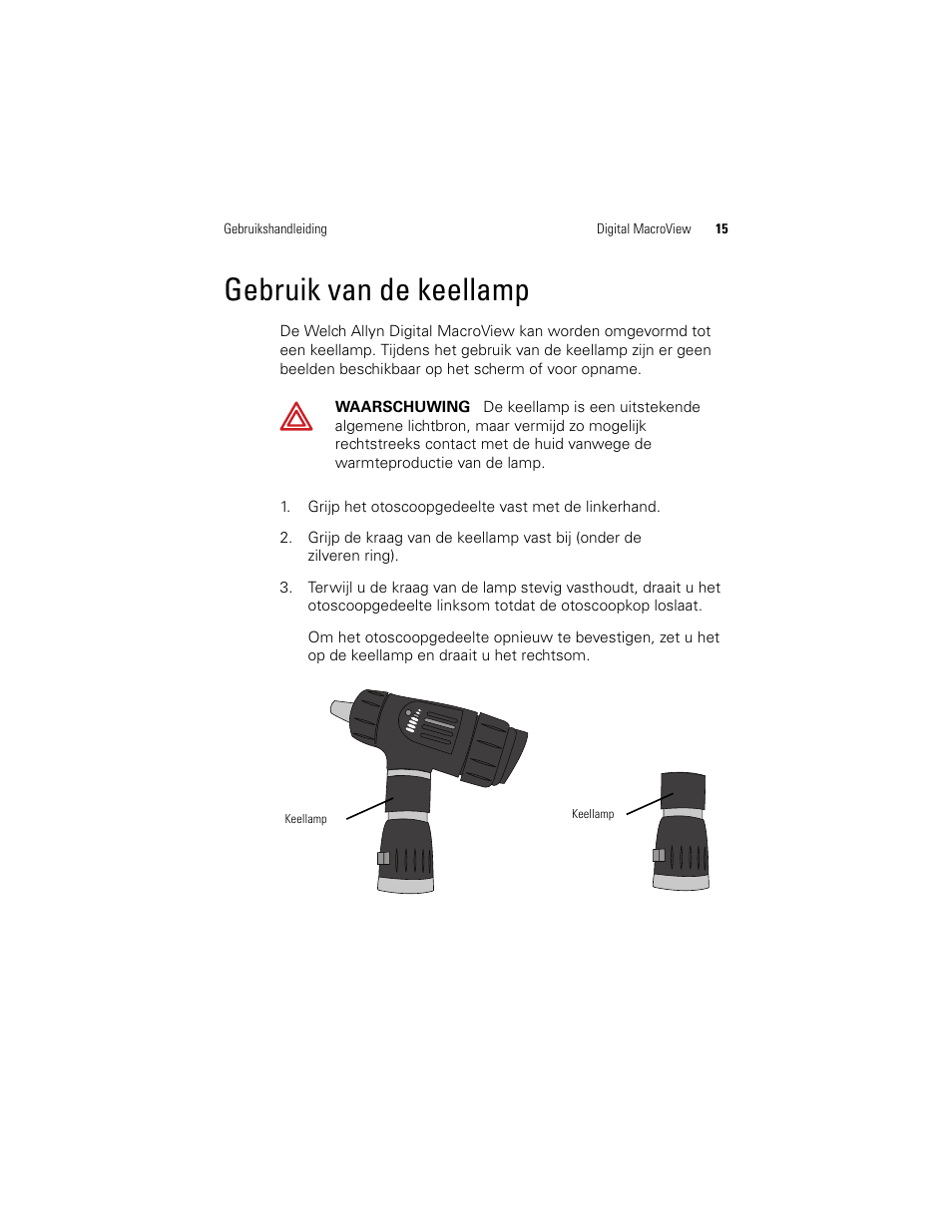 Gebruik van de keellamp | Welch Allyn Digital MacroView Otoscope - User Manual User Manual | Page 215 / 476