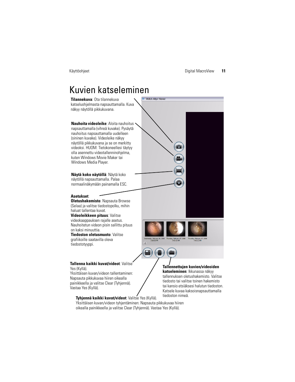Kuvien katseleminen | Welch Allyn Digital MacroView Otoscope - User Manual User Manual | Page 245 / 476