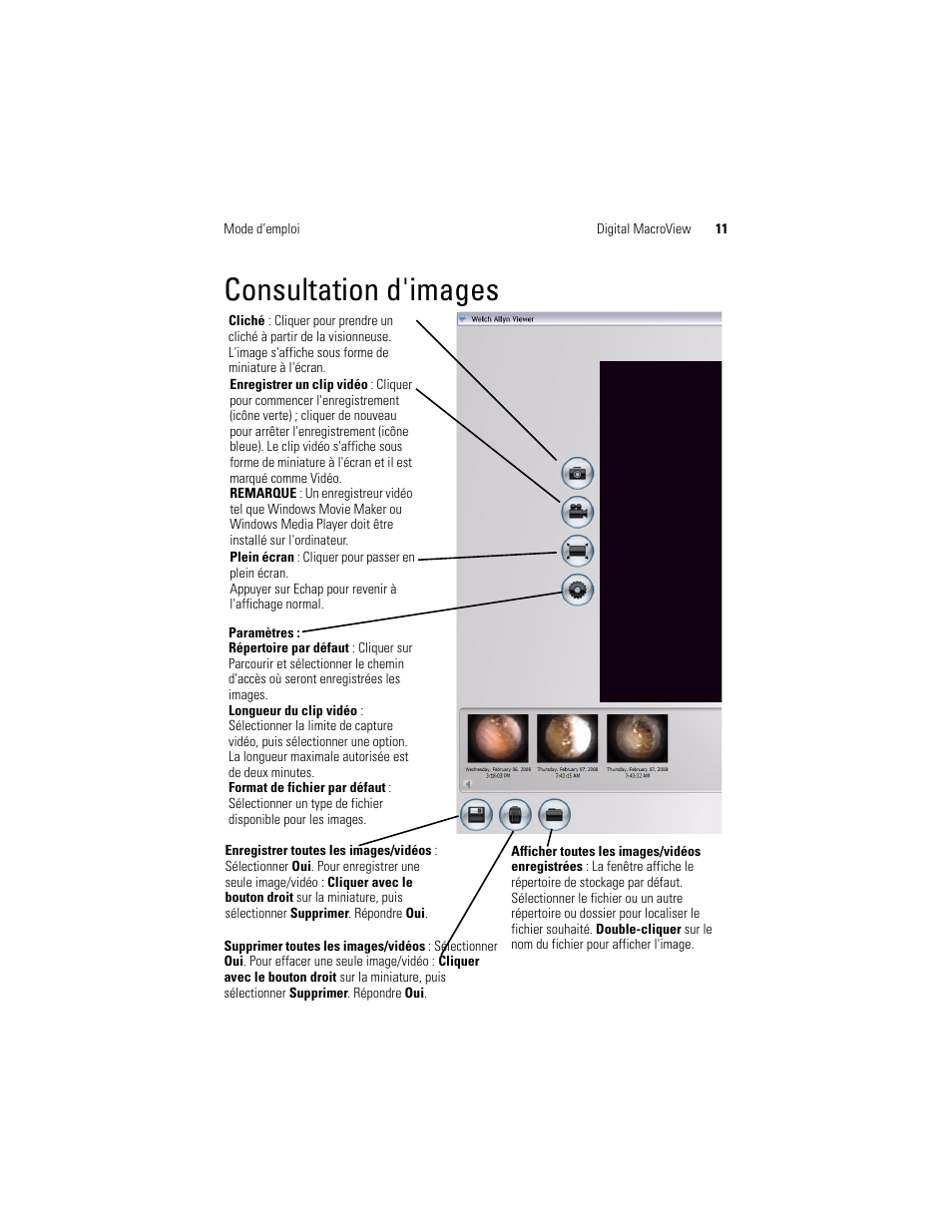 Consultation d'images | Welch Allyn Digital MacroView Otoscope - User Manual User Manual | Page 277 / 476