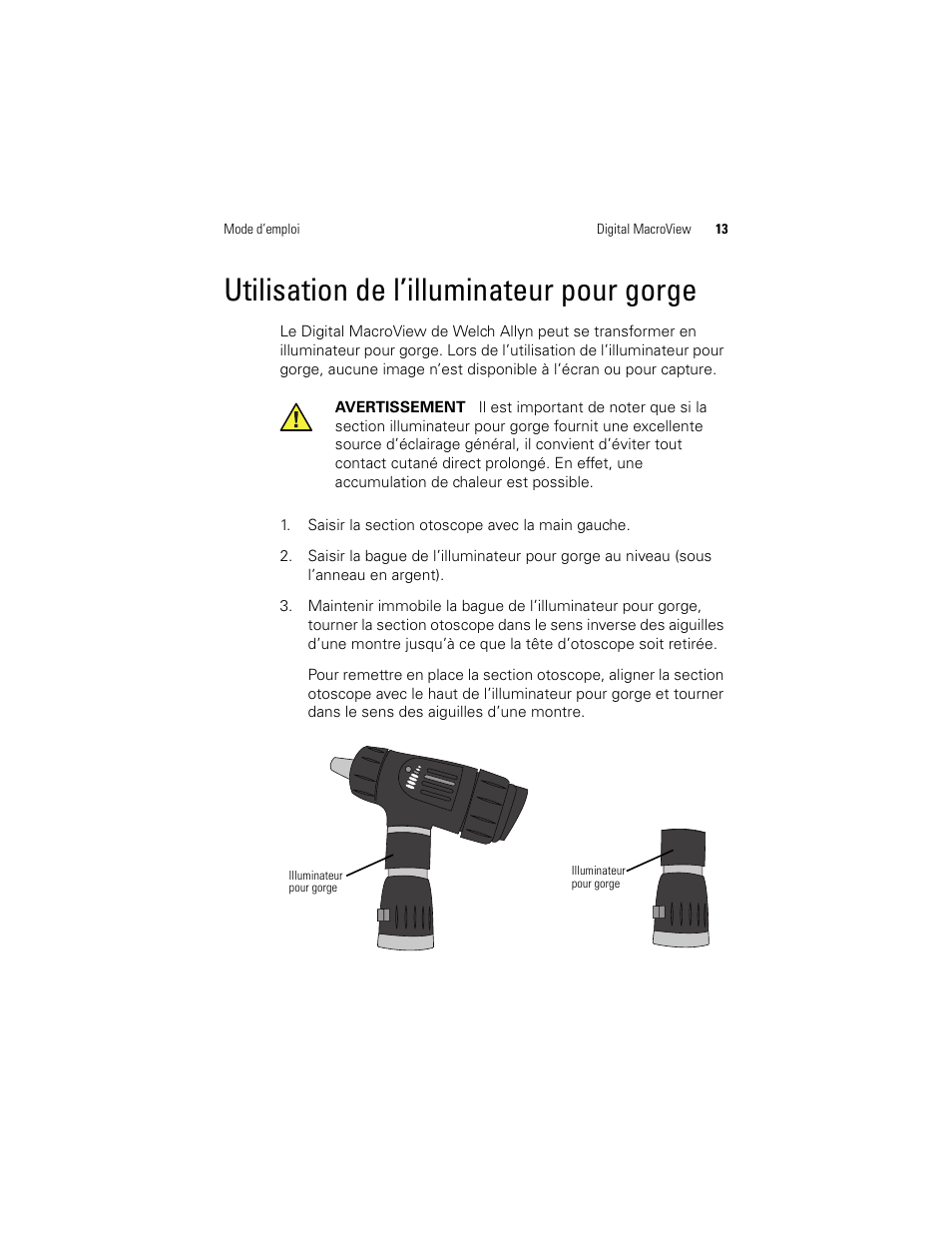 Utilisation de l’illuminateur pour gorge | Welch Allyn Digital MacroView Otoscope - User Manual User Manual | Page 279 / 476